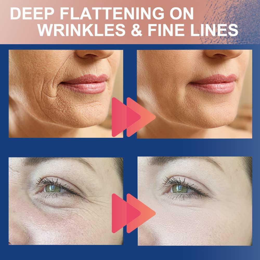 Akissos Akissos Forehead and Between Eyes Wrinkle Patches The Original Wrinkle Patch Non Invasive Wrinkle Smoothers for Forehead Wrinkles 5cm*5m 1 Roll…