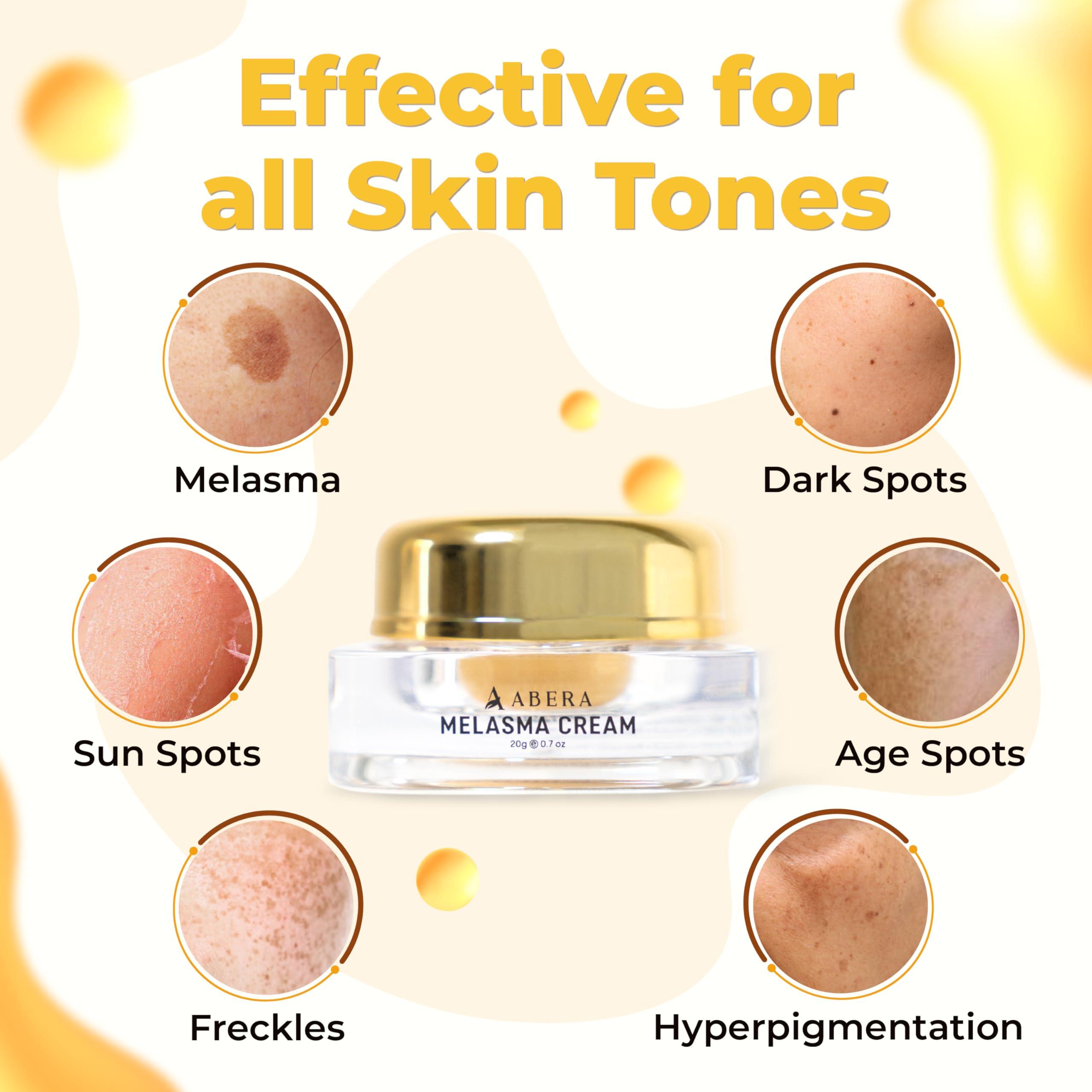 ABERA ABERA Dark Spot Remover for Face: Dark Spot Corrector for Age Spot Sun Spot Freckles Melasma Brown Spot - Faded Spot Correcting Cream for Face Hands (3 Boxes)