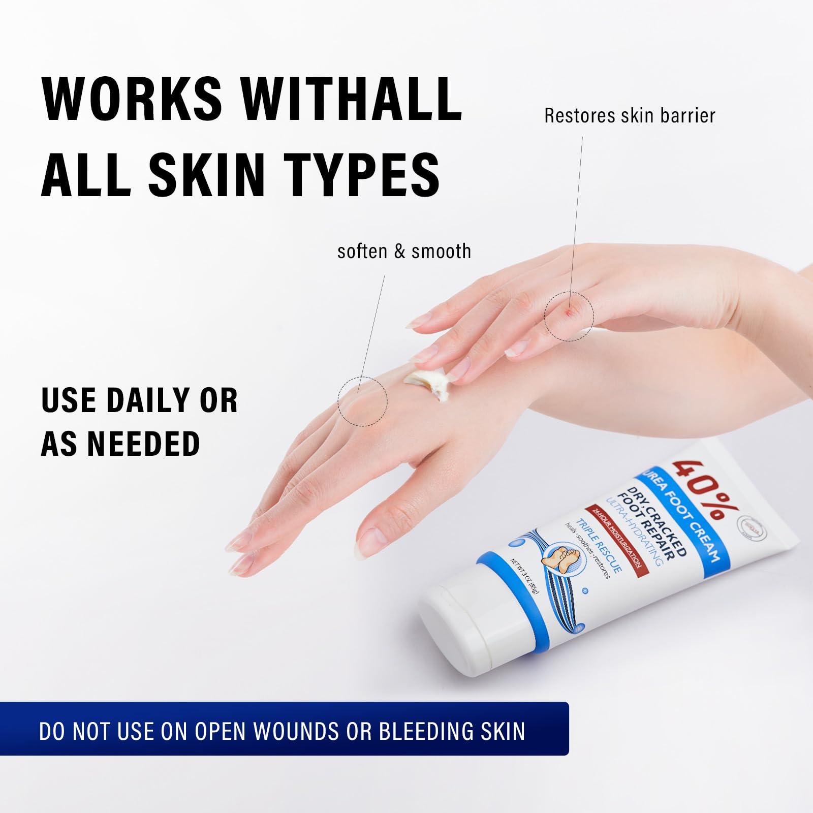 OUKEYA OUKEYA Urea Cream 40 Percent Tube 3 Oz, Urea Foot & Hand Cream for Dry Cracked, 40 per Urea Lotion for Feet Maximum Strength 3 Ounce(Pack of 3)
