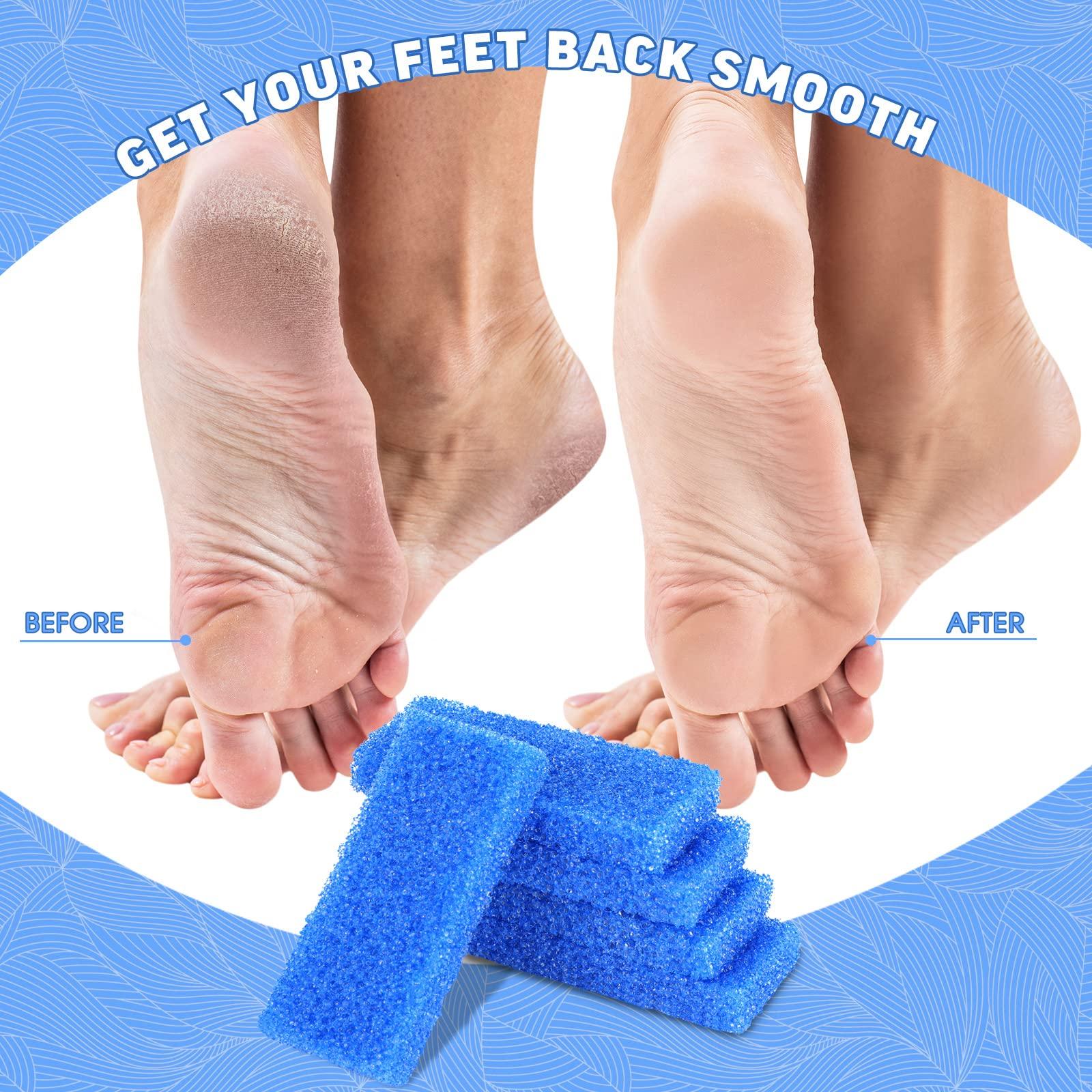 Therwen Therwen 400 Pcs Disposable Pumice Stone for Feet Blue Foot Scrubber Dead Skin Callus Remover for Salon Spa Home