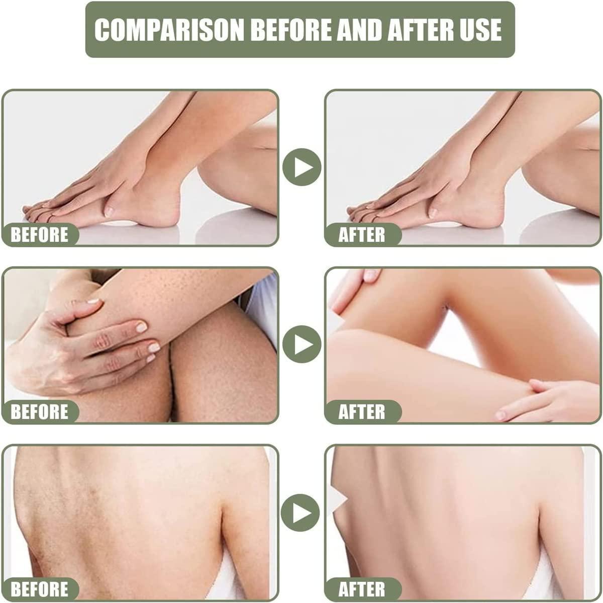 Hoddl Smooth Cream,Deeply Moisturize& smooth skin,for Rough and Bumpy Dry Skin (3Pcs)