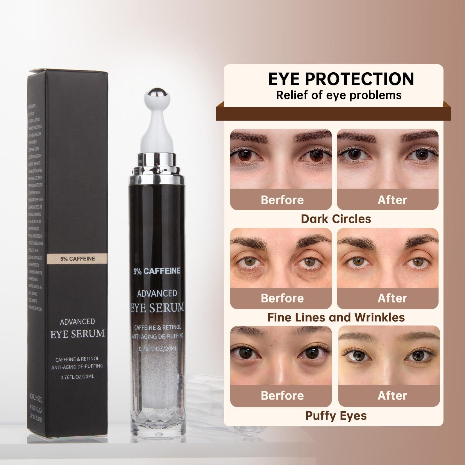 mopayzer Caffeine Eye Cream for Puffiness & Dark Circles, Under Eye Cream for Puffy Eyes, Eye Bags & Wrinkles, 2 PCS Anti Aging Eye Serum with Under Eye Roller, Reduces Fine Lines & Moisturize Skin.