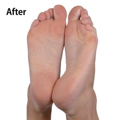 Emjoi Emjoi Micro-Pedi Nano Pro Callus Remover w/Manicure Kit & Extra Rollers (Burgundy)