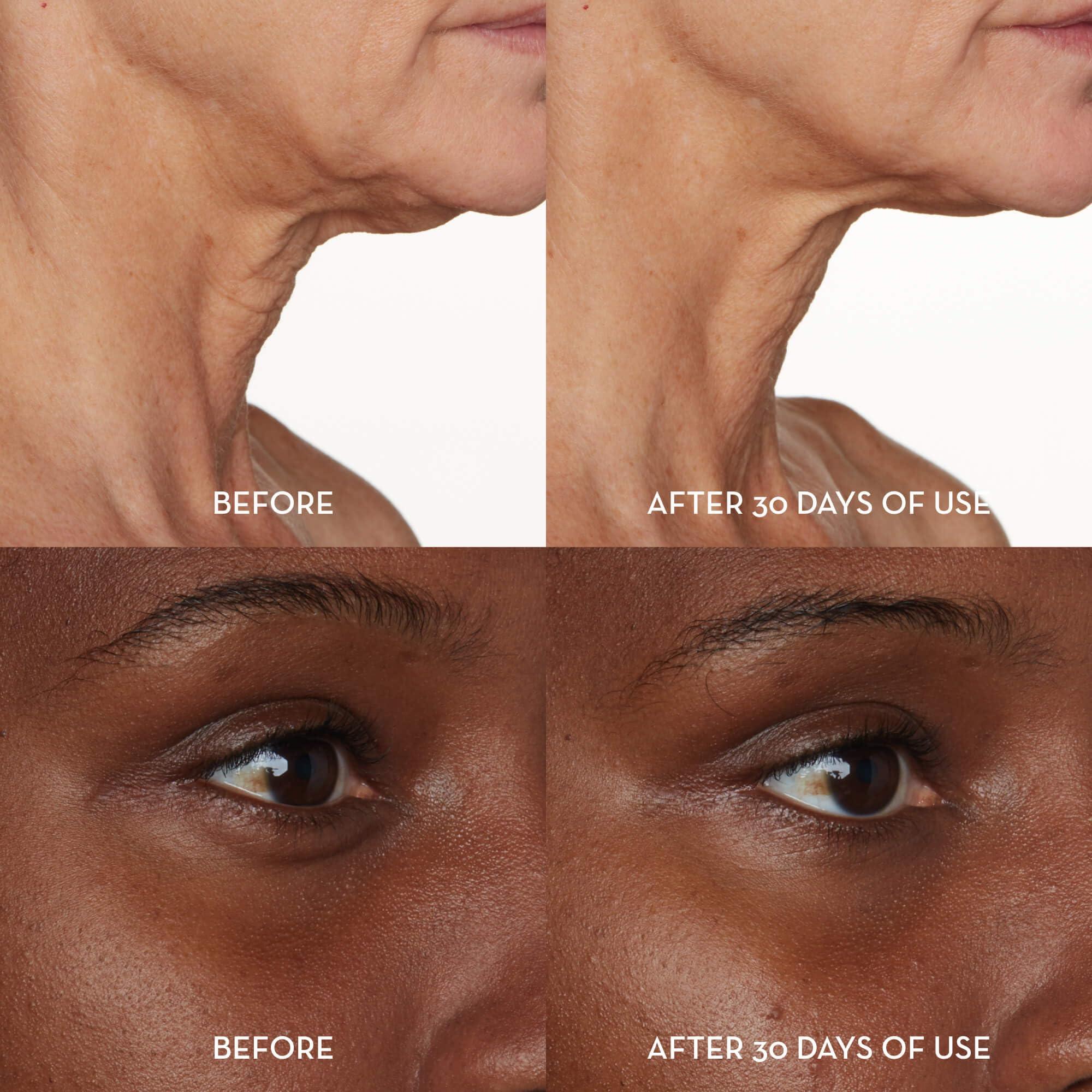 Furtuna Skin Face & Eye Serum - Dual-Use Formula to Lift, Reduce Puffiness and Even Tone, Wild-Foraged Botanicals, Vegan, Dermatologist Tested, EWG Verified, 15ml