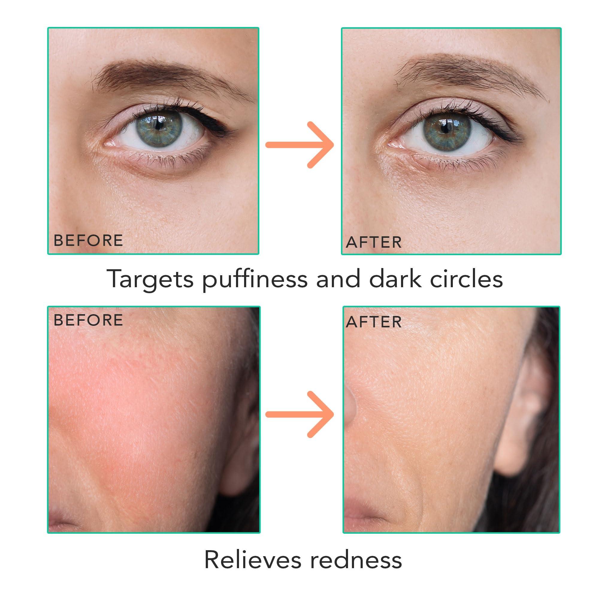 Beauty by Earth Ice Roller for Face - Smoothes Fine Lines & Wrinkles, Face & Eye Roller for Puffy Eyes, Skin Care Massager, Beauty Gift That Helps Relieve Migraines, Facial & Spa Gifts for Women