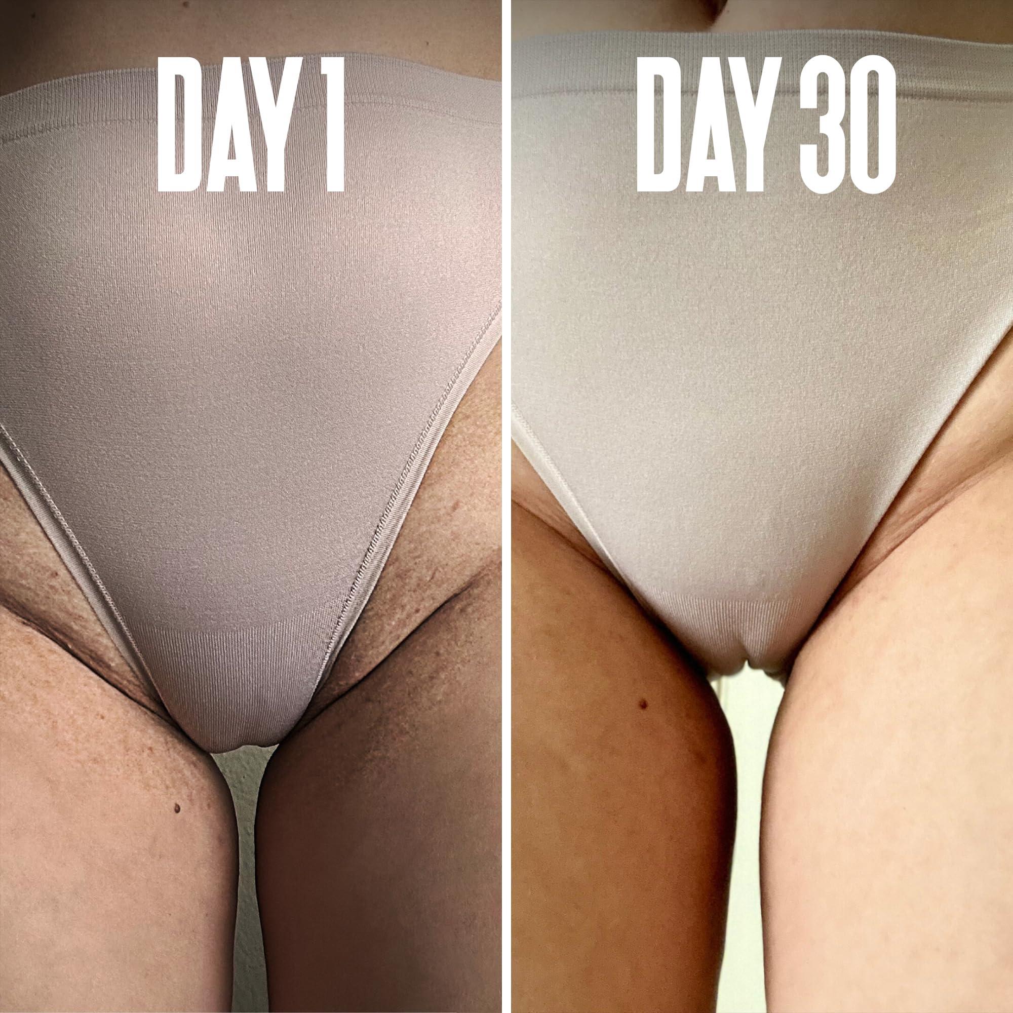 Divine Derriere Save 18% on The Skin Care Solution For Dark Spots, Razor Bumps, Ingrown Hair & Razor Burns – Includes Our Ultra Potent Brightening + Razor Bumps Pads For an Ultra Clear & Glowing Skin