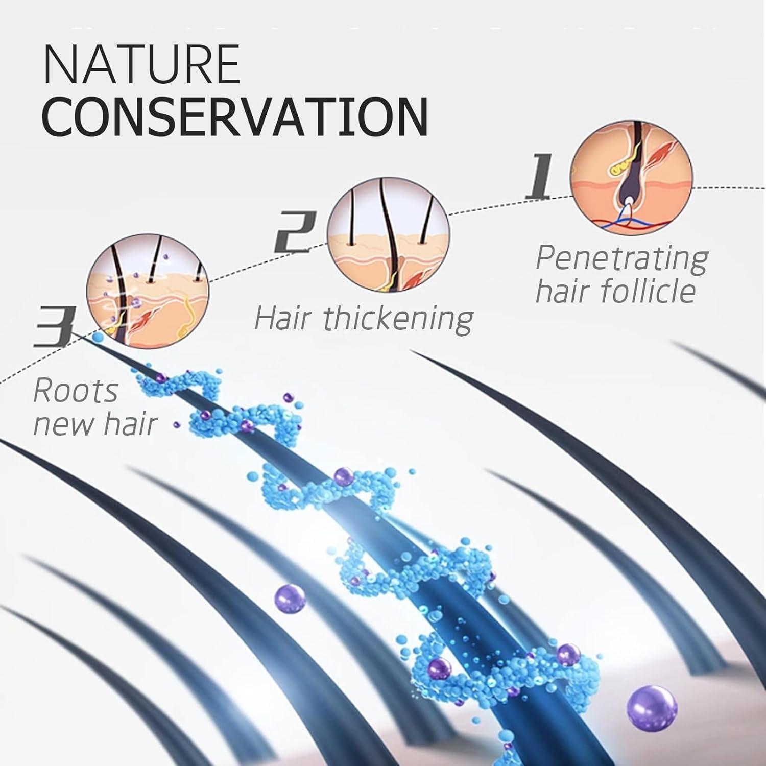 Ginaday 2 Box Ginger Plant Extract Shampoo for Hair Growth and Anti-Loss Control, Hair Growth Oil Care by Ginaday