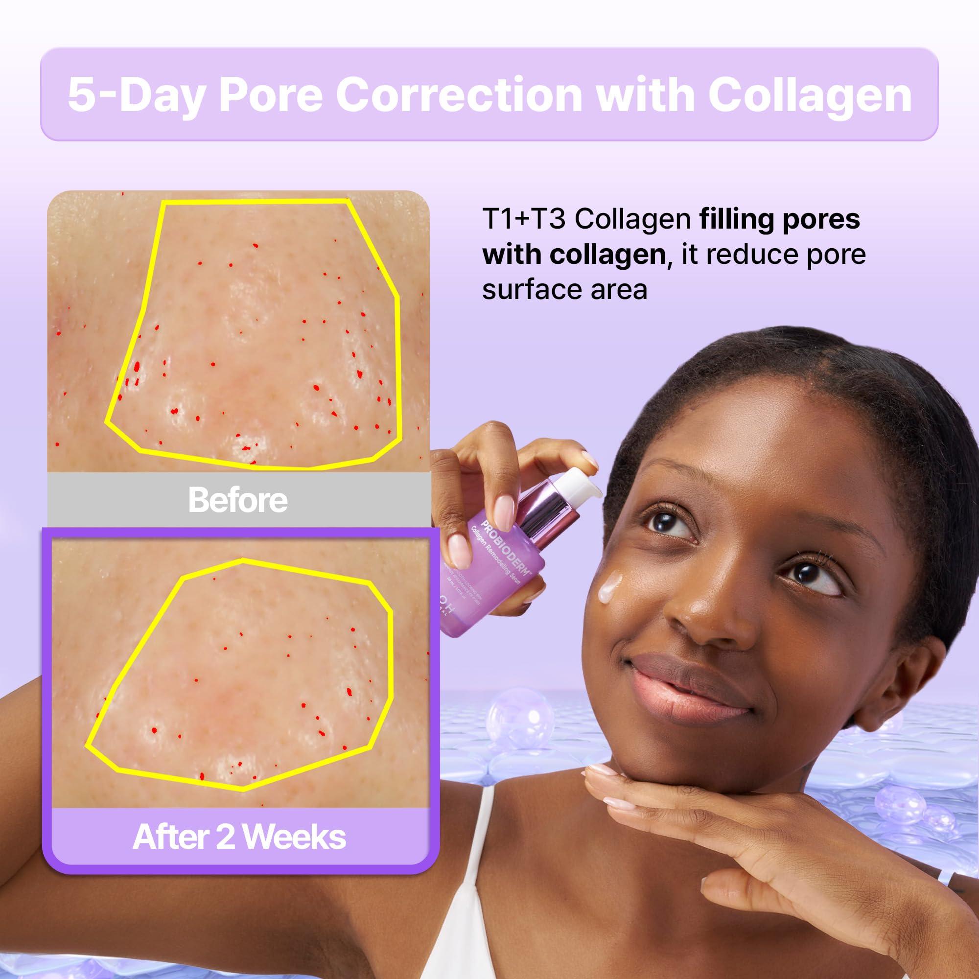 BIOHEAL BOH BIOHEAL BOH Probioderm Collagen Remodeling Serum 1.01 fl oz (30 ml) | Skin Firming Serum with Collagen & 12 Peptides for Pore Tightening & Smoothing | Hydrating & Lifting for Daily Skincare