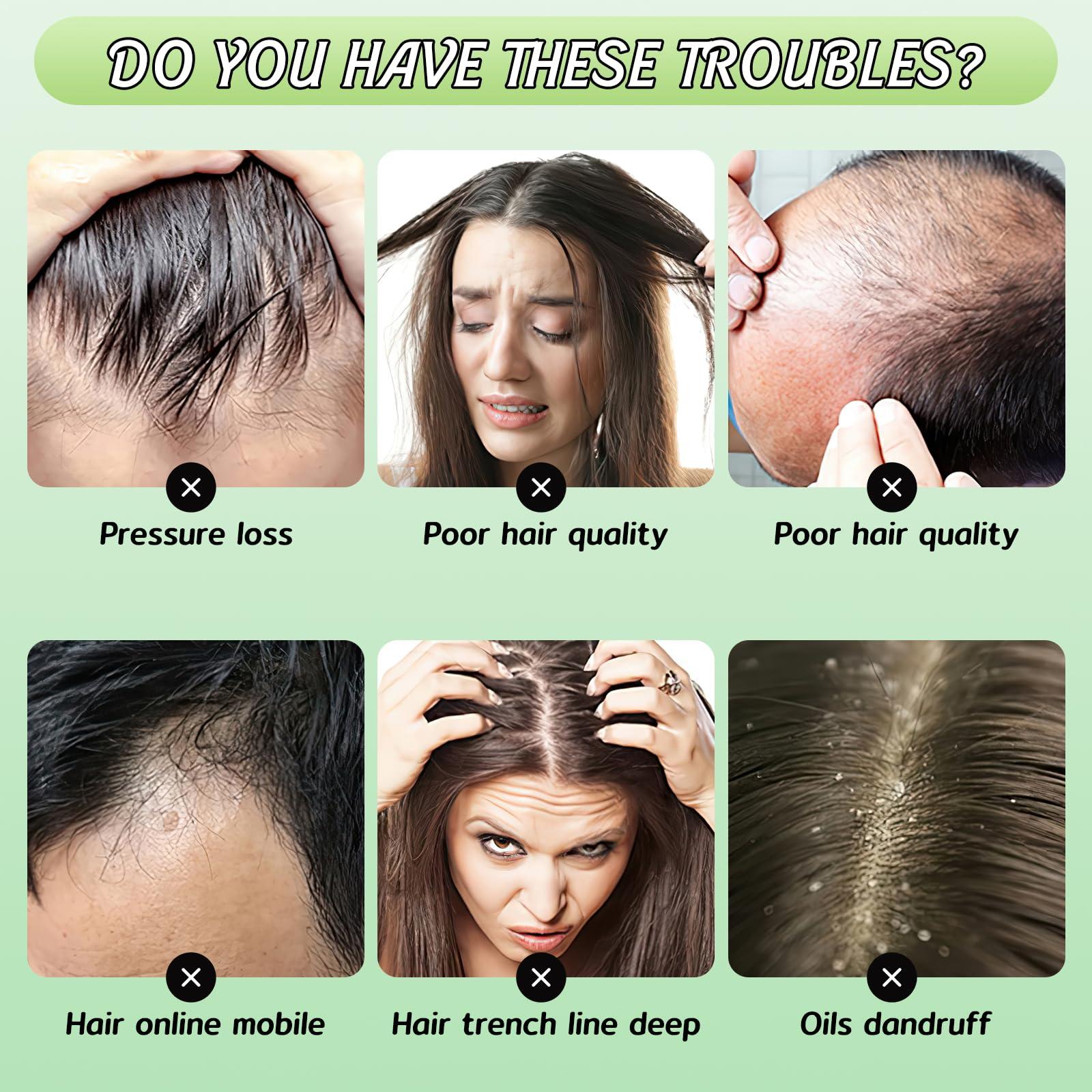 YOUSHEME Ginger Plant Extract Anti-Hair Loss Shampoo, for Women Men Hair Strengthening & Nourishing (2box*20pcs)