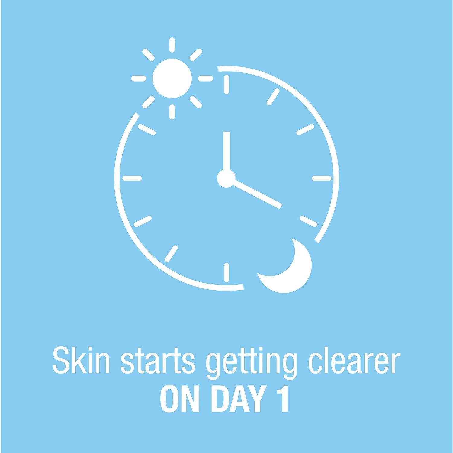 Neutrogena Neutrogena On-The-Spot Acne Treatment 0.75 oz. (Pack of 6)