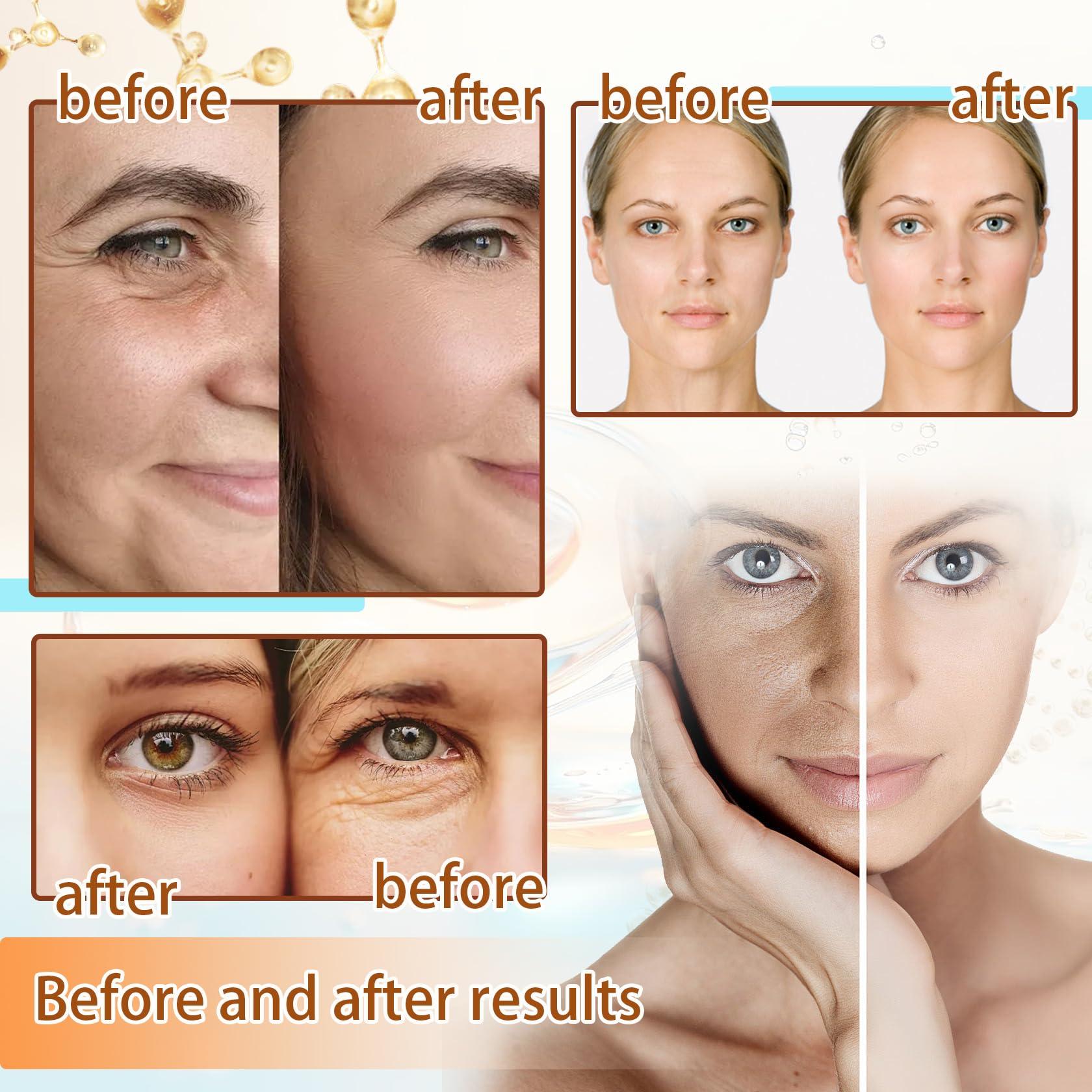 BKPPLZP BKPPLZP Collagen Anti-Wrinkle Mask 3P