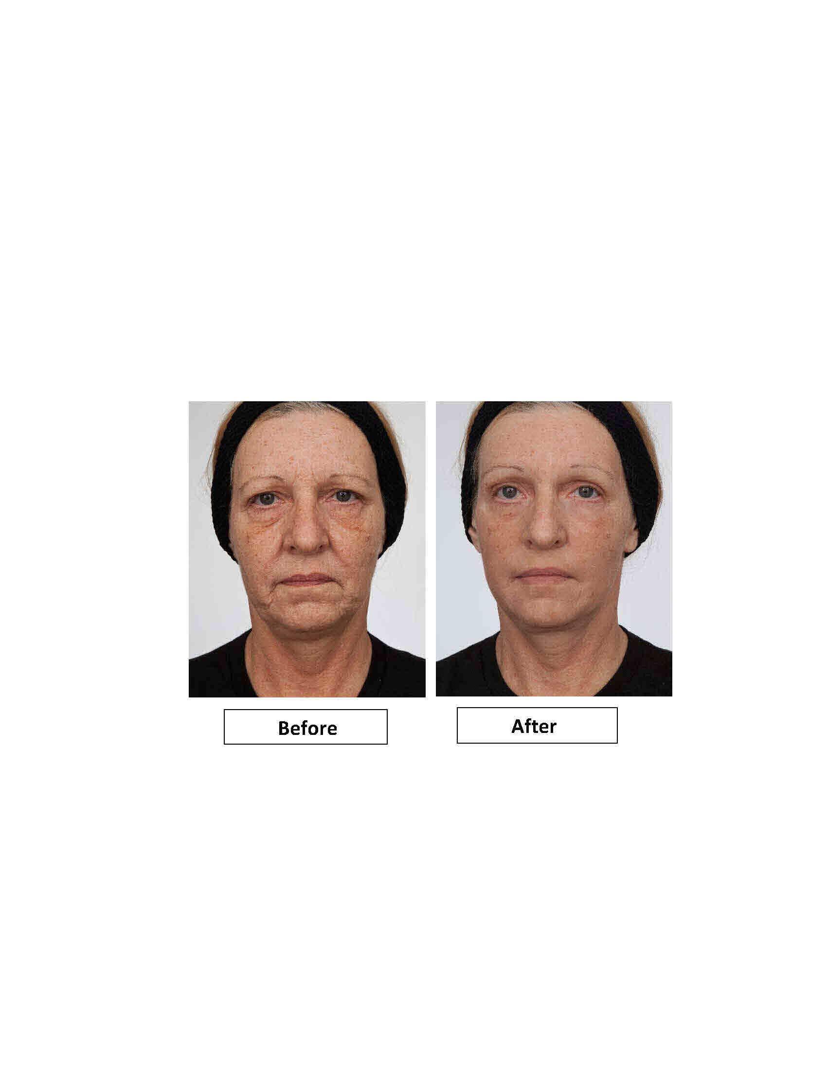 Dr.Sevinor Skincare Solutions Dr Sevinor Wrinkle Solution Wrinkle Smoothing Tinted Serum 1 FL OZ