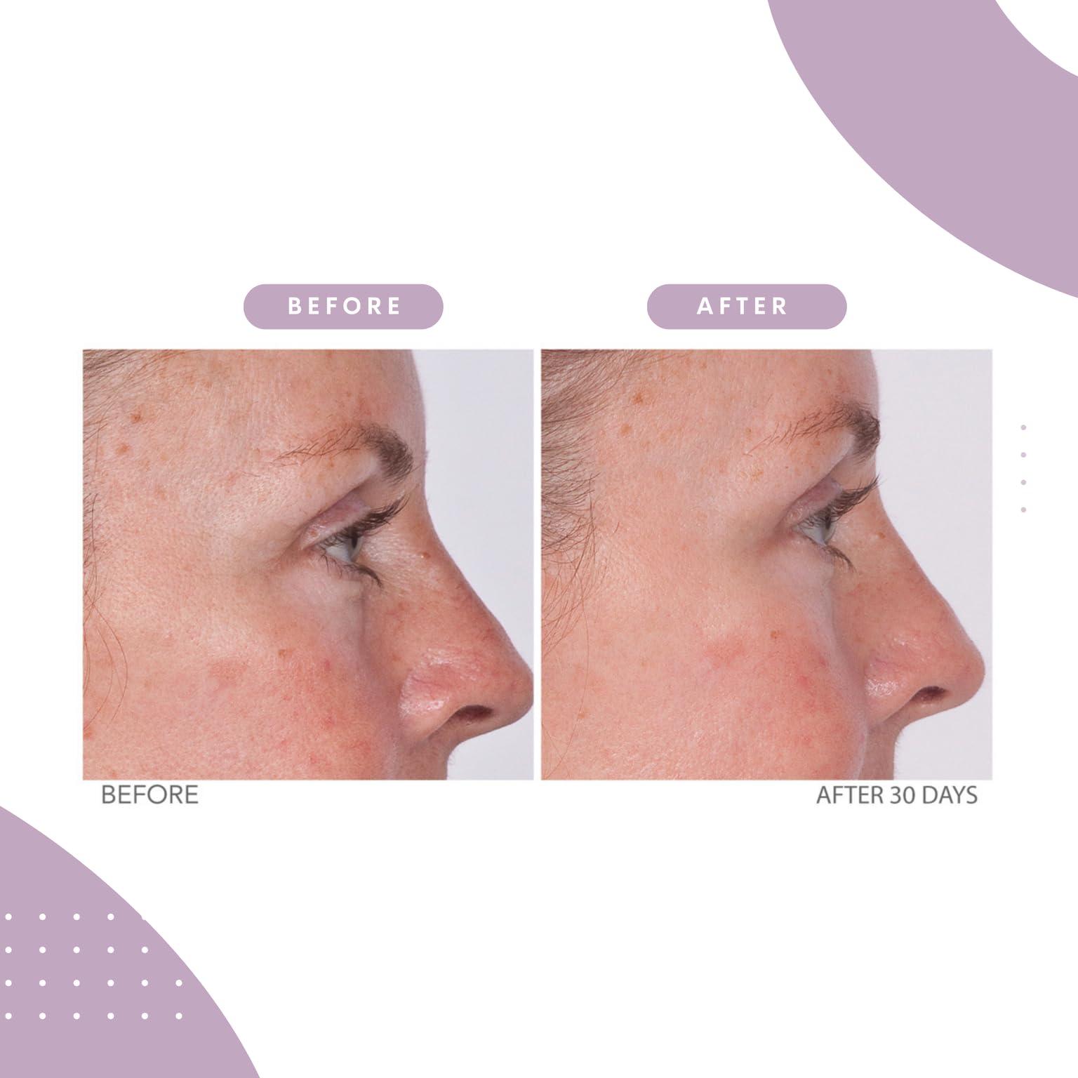 Serious Skincare Serious Skincare - Reverse Lift Eye Cream Moisturizer with Peptides - Skin Firming Wrinkle Formula - Temporarily Lift & Firm Eye Lids and Eye Area Women, Men - 1 Fl. Oz.