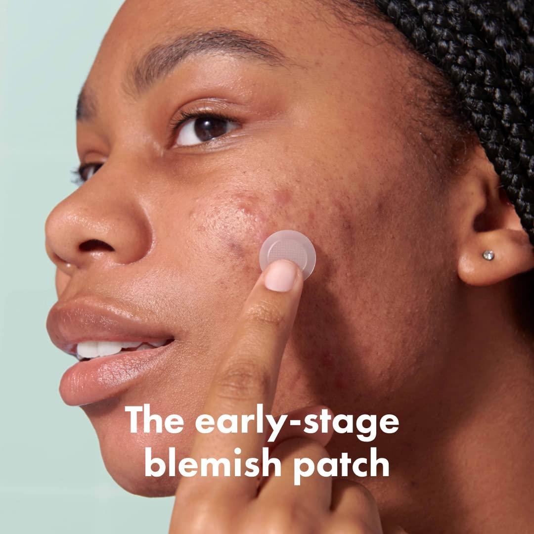 Mighty Patch Mighty Patch Micropoint for Blemishes from Hero Cosmetics - Hydrocolloid Acne Spot Treatment Patch for Early Stage Zits and Hidden Pimples, 395 Micropoints (8 Patches)