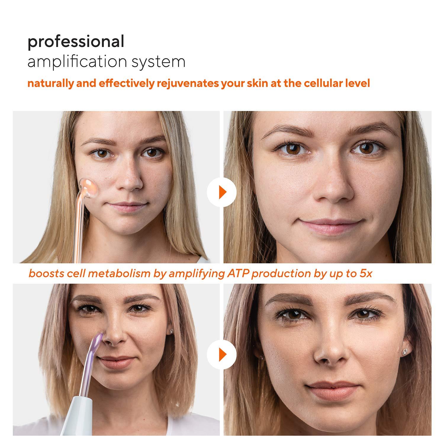 Pure Daily Care NuDerma Professional Skin Therapy Wand - Portable Skin Therapy Machine with 6 Neon & Argon Wands Boost Your Skin Clear Firm & Tighten