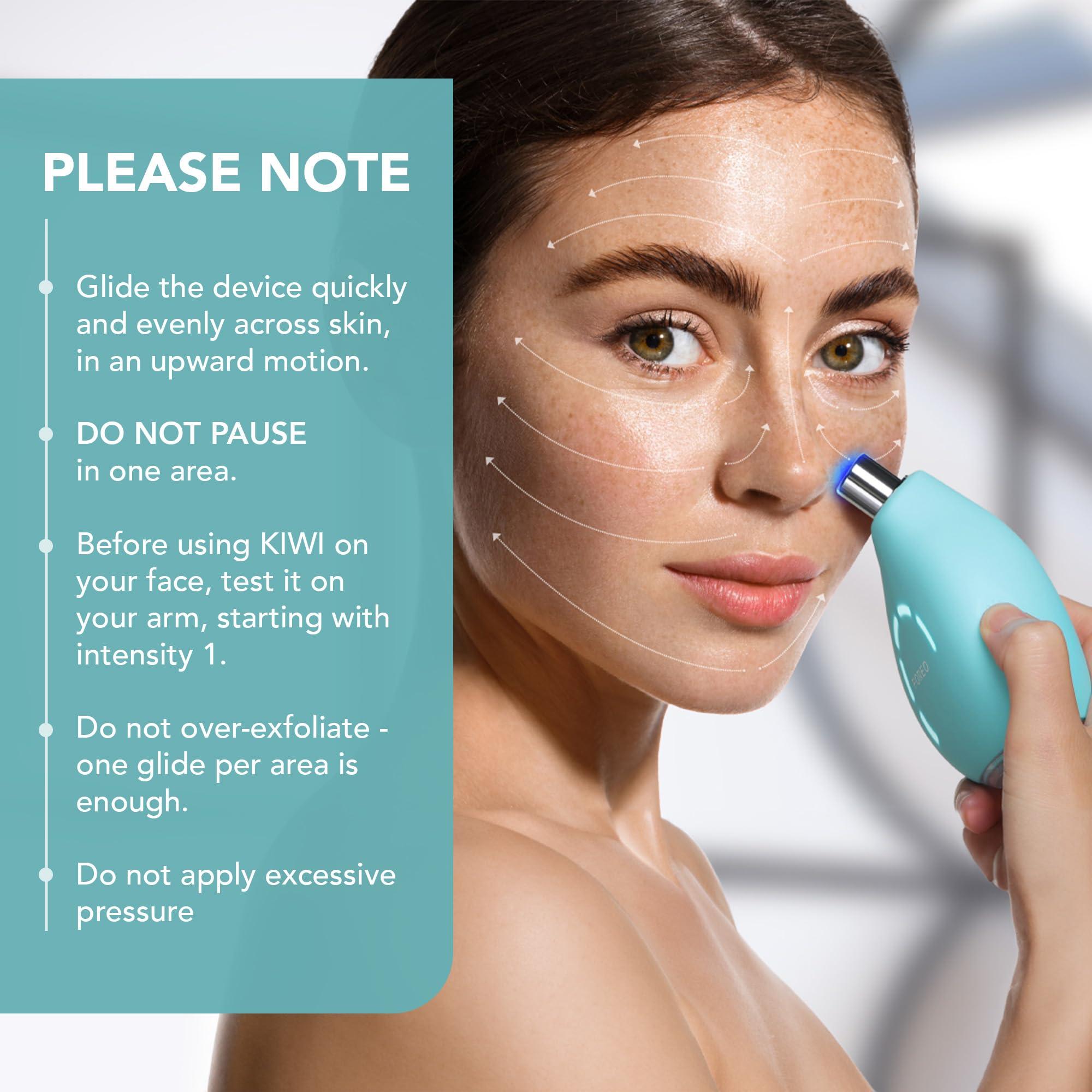 FOREO FOREO KIWI Whitehead & Black Head Remover for Face - Facial Skin Care Tools - Blackhead Extractor for Face & Nose - No Pore Strips Suction - Quick & Effective Blackhead Remover Device