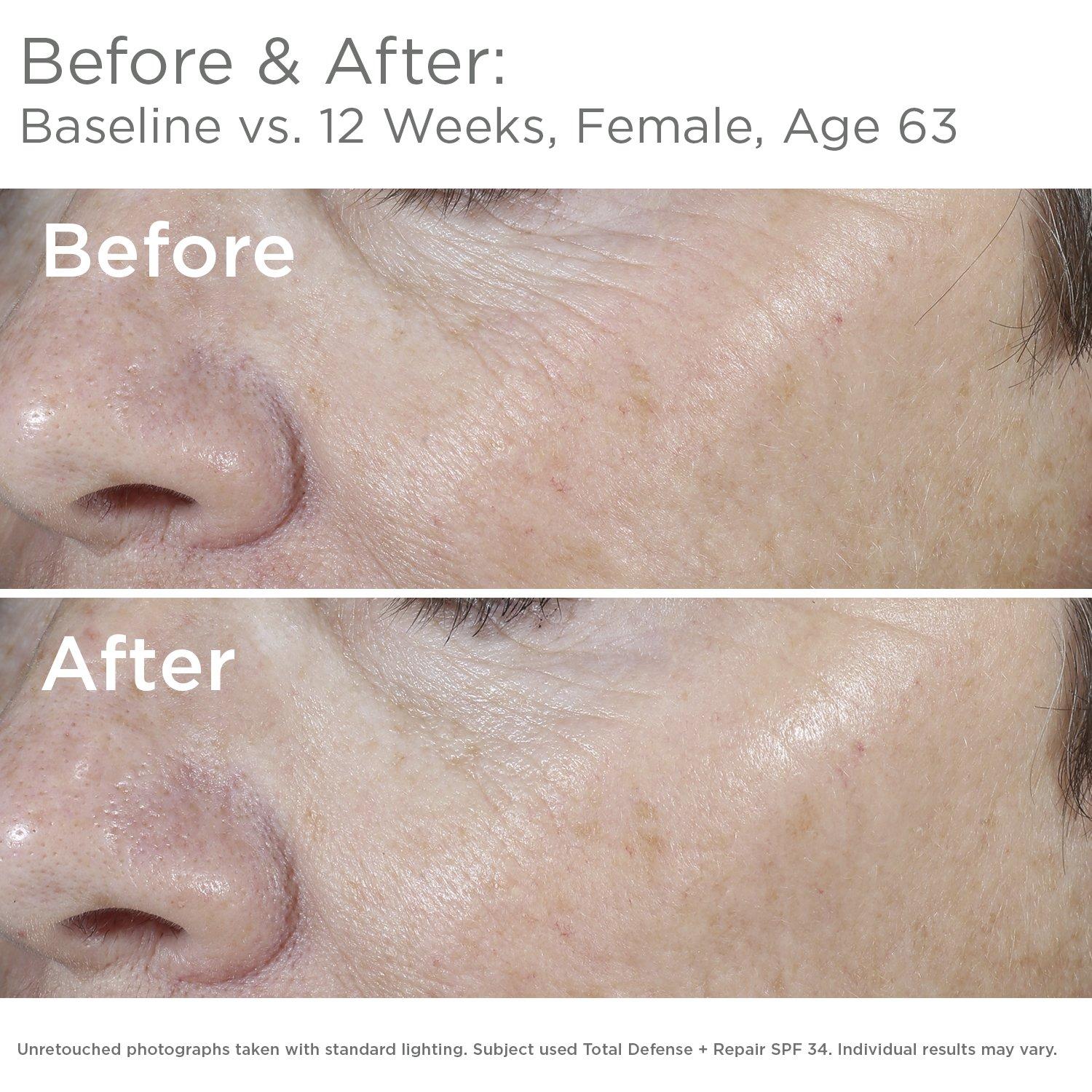 SkinMedica SkinMedica Total Defense + Repair SPF 34 Sunscreen for Face. This Lightweight, Facial Sunscreen is Ideal for Oily and/or Combination Skin, 2.3 Oz