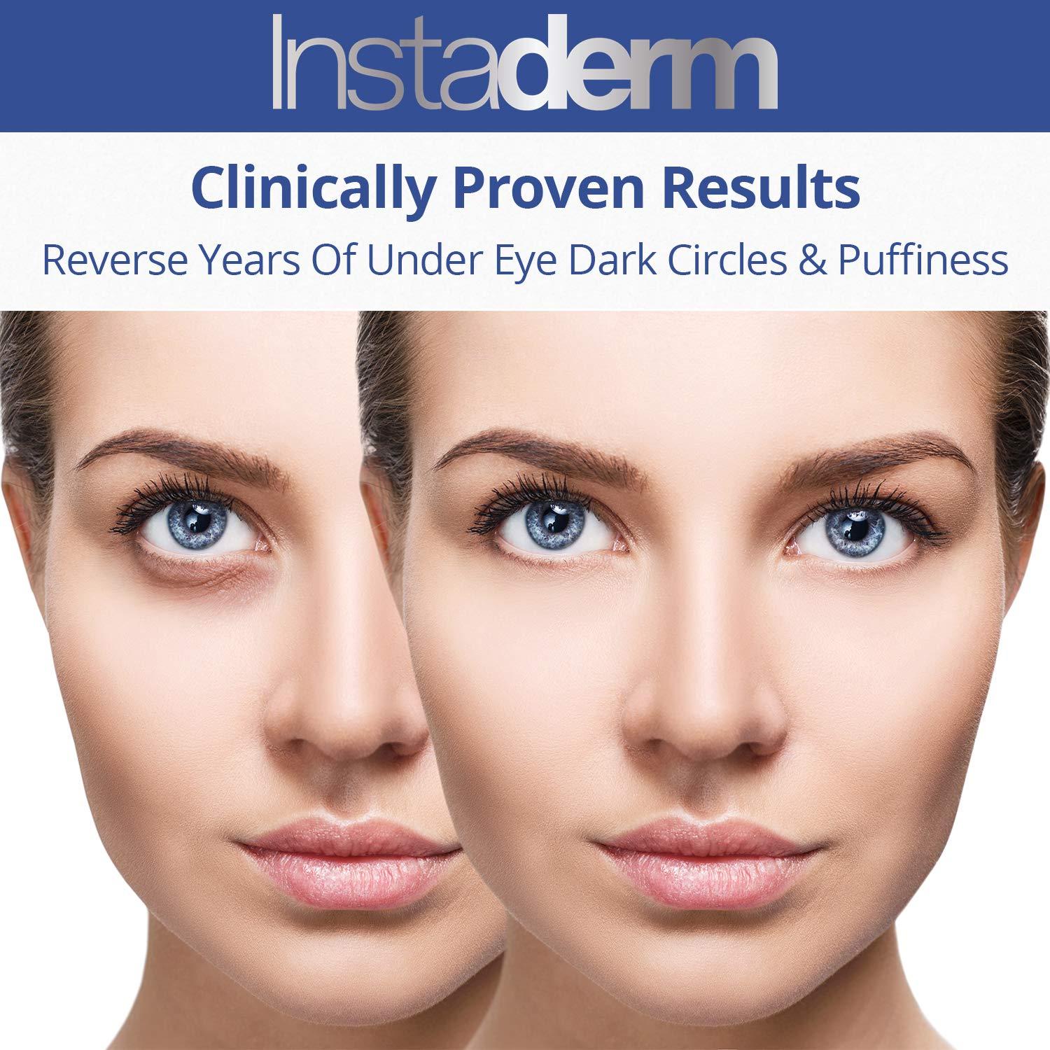 Instaderm Instaderm Vitamin K Cream- Bruise Healing Formula with Arnica. Dark Spot Moisturizer for Bruising, Spider Veins & Broken Capillaries. Repair Under Eye Dark Circles, & Puffiness.