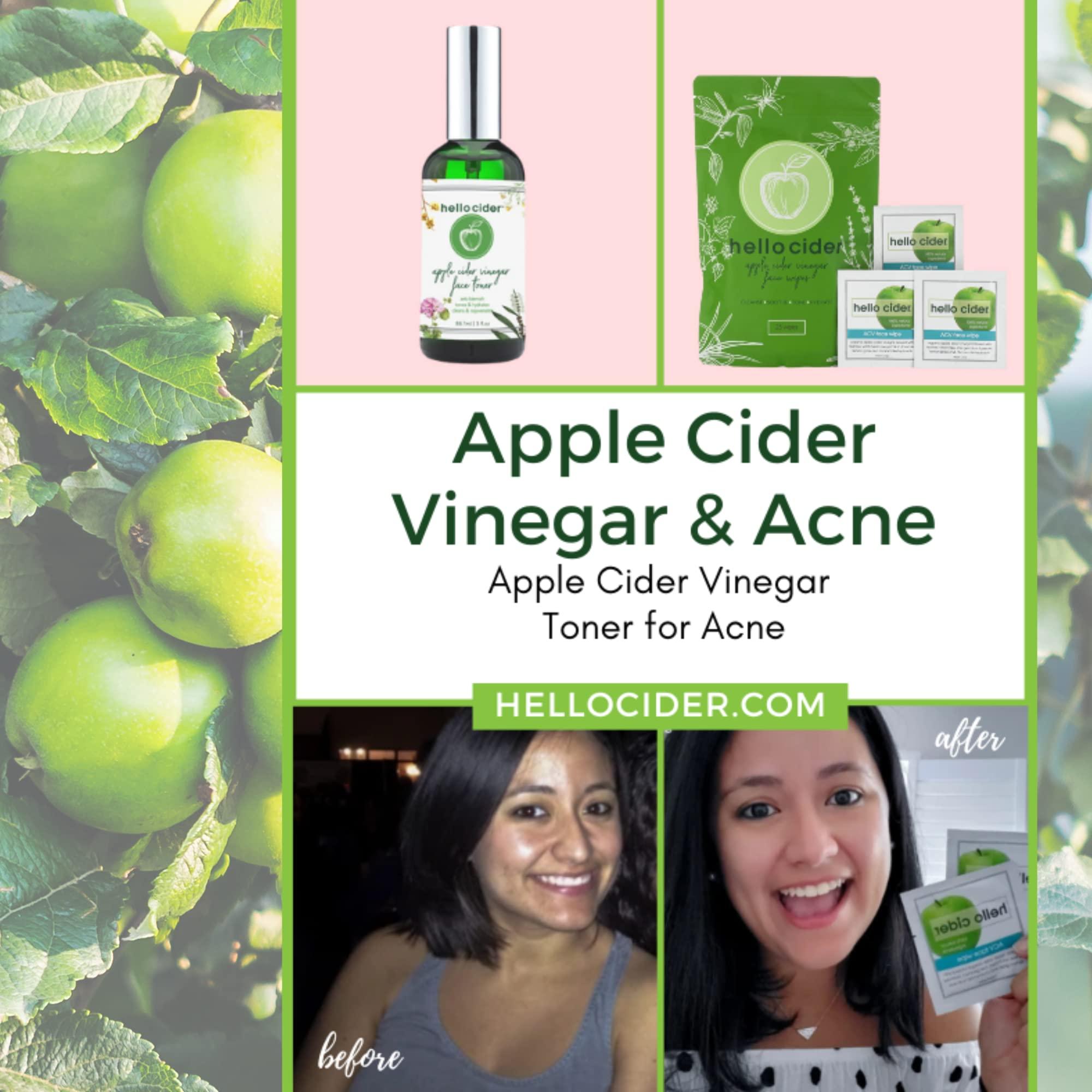 Hello Cider Apple Cider Vinegar Acne Face Wipes-Organic TeaTree, Rose, Chamomile, Witch Hazel.Oil free. Reduce Blemish & Acne. Tone,Restore, Sooth, Balance pH. Dry, Normal, Sensitive Skin. 25ct. USA Hello Cider