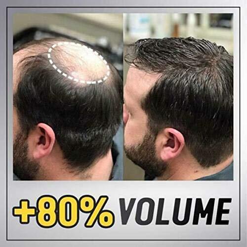 Qheng Qheng Bald Patch, Men Hair Topper Short Straight,Toupee Hairpiece Hair Extensions for Covering White Loss Hair for Men Women