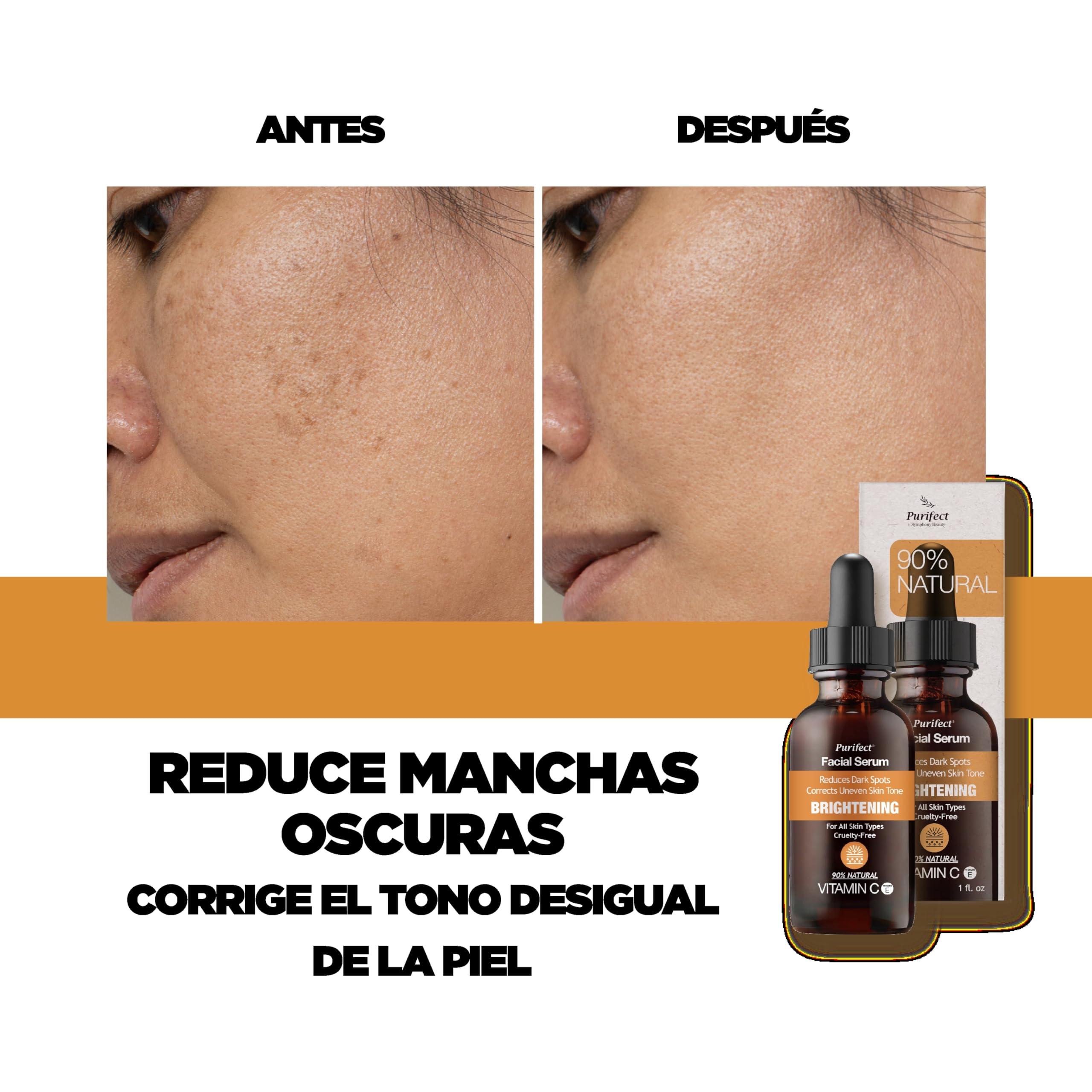 Purifect by Symphony Beauty Purifect Natural Vitamin C Vegan Facial Serum - Enhances Skin Radiance, Hydration, and Firmness with Niacinamide & Vitamin E, 30ml (Made in the USA)