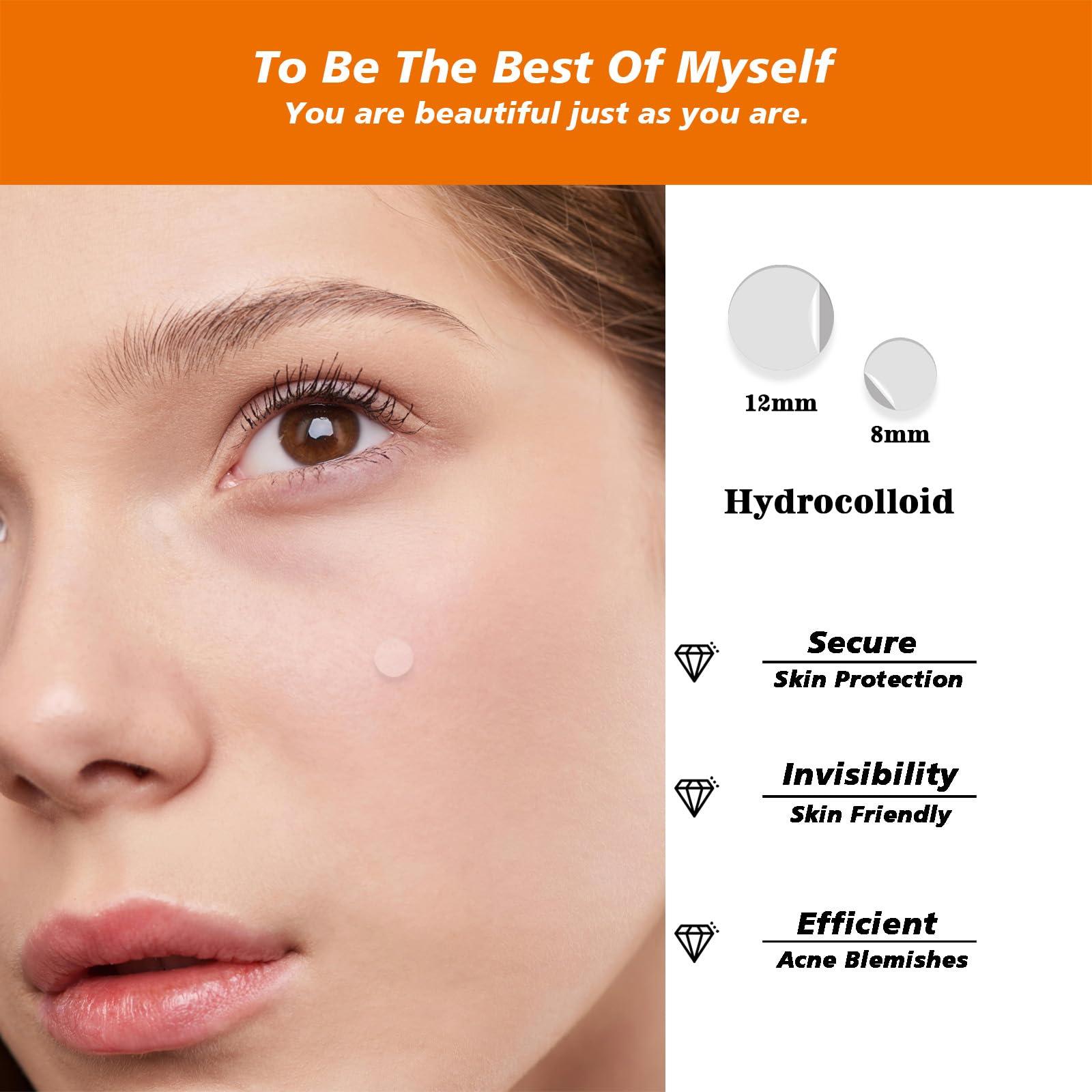 Leoezx Leoezx Acne Pimple Patches 72 Pcs,Acne Spot Dots,Facial Acne Patch,Hydrocolloid Acne Patch for Face,All Skin TypesAcne Patch & Pimple Patch