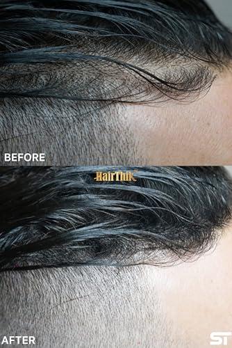 Supreme Trimmer Hair Building Fibers 8-in-1 Kit | includes 25G Keratin Fibers, Pump Nozzle, 2 Hairline Cards, S&L Shaker, Brush, Wipes, Mirror | Conceal Thicken Thinning Balding Hair | Men & Women (Black)