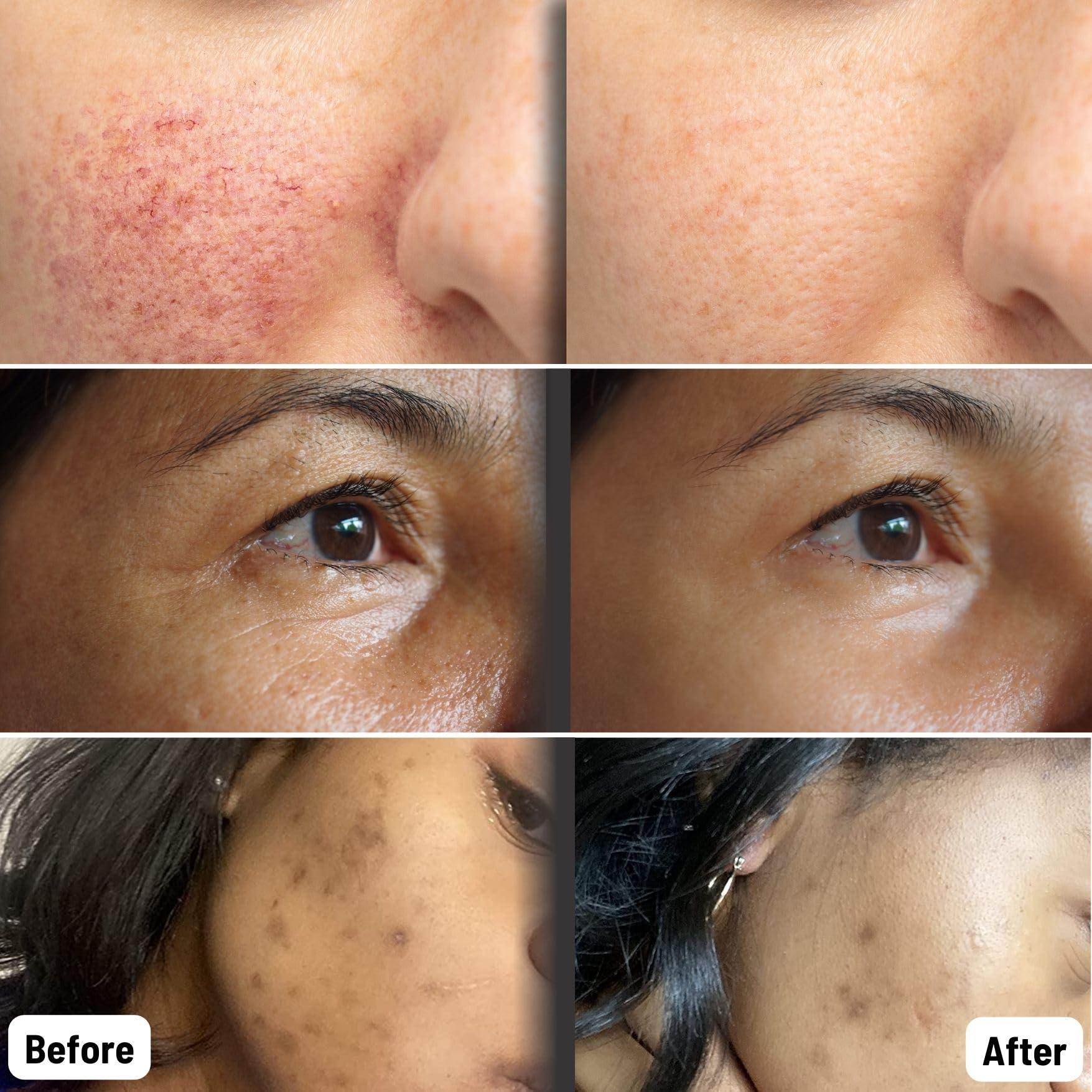 ORGAID ORGAID Organic Sheet Mask | Made in USA (Vitamin C & Revitalizing, pack of 4)