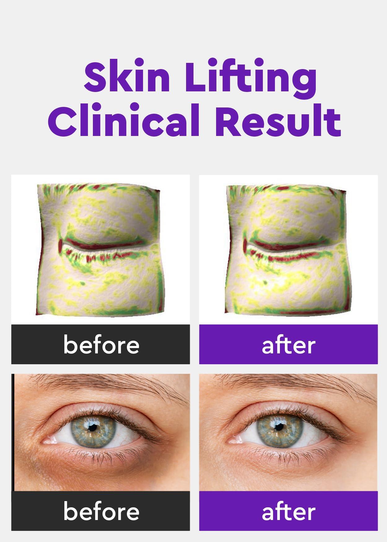 BE+WANTS Bewants Phyto Collagen Roll-On Eye Serum Stick with 61% bamboo water, 10% phytocollagen, refreshing under eye roll-on massage 2 pack, Ideal for Valentine\'s Day Gift