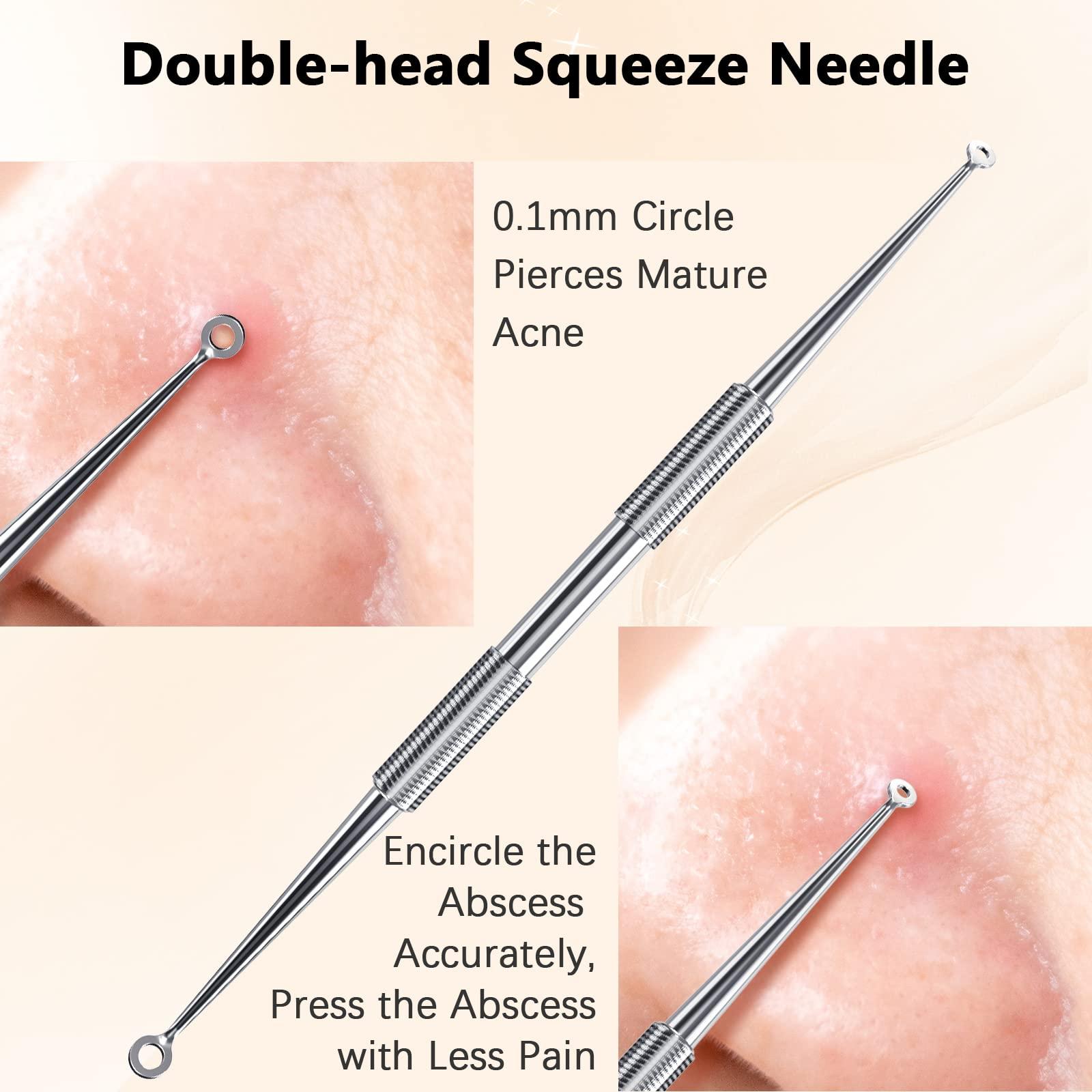 TAYTHI TAYTHI Blackhead Remover Tool, Pimple Popper Tool Kit, Blackhead Extractor Tool for Face, Extractor Tool for Comedone Zit Acne Whitehead Blemish, Stainless Steel Extraction Tools (Pack of 2)