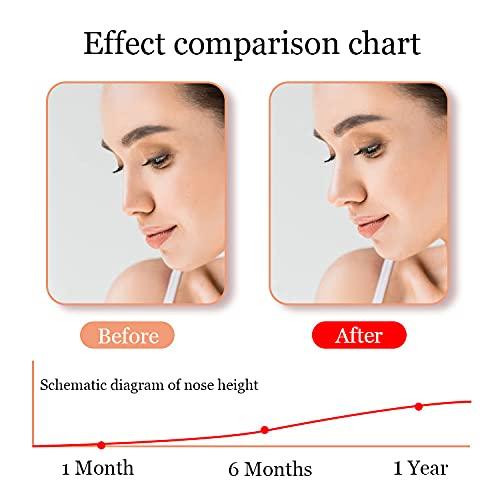 jieri Jieri Nose Shaper Lifter Clip - Reshape & Straighten Wide Noses for Men & Women
