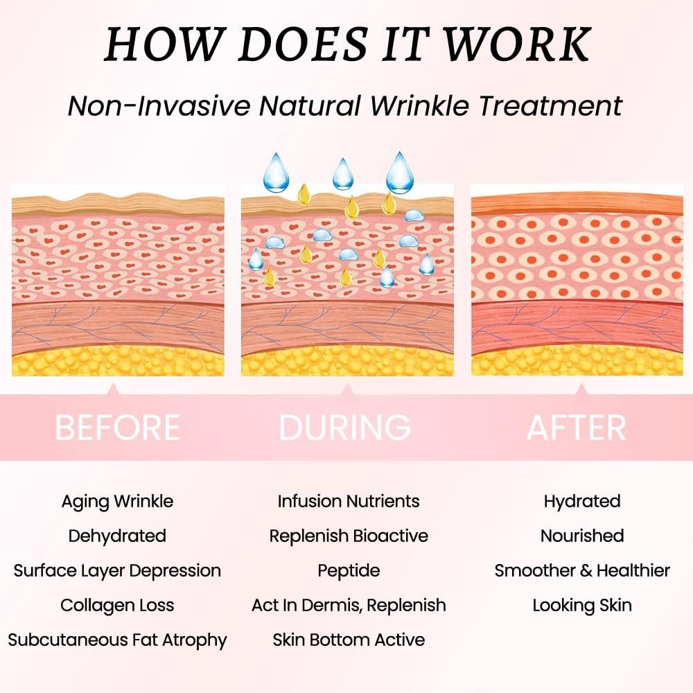 evpct evpct 1Pcs Silicone Chest Smoothing Wrinkle Pads Reusable, Silicone Anti Chest Wrinkle Patches Reusable for Chest Wrinkles Overnight, Dcollet Chest Wrinkle Pillow Pads for Smoother, Size XL-Angel