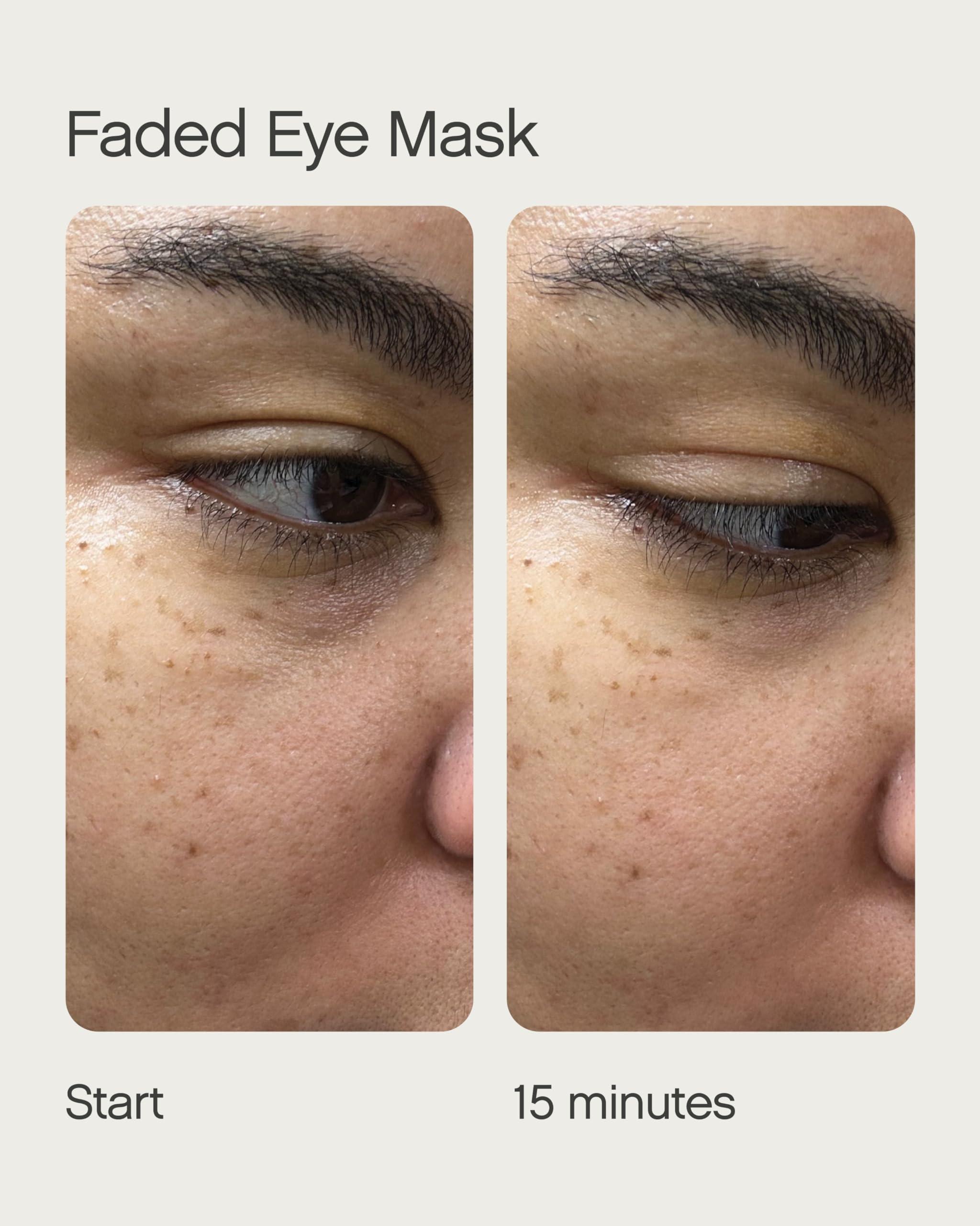 Topicals Topicals Faded Starter Kit, The Brightening & Clearing Bundle - Faded Serum for Dark Spots (0.5oz) and Faded Under Eye Masks (Set of 6)