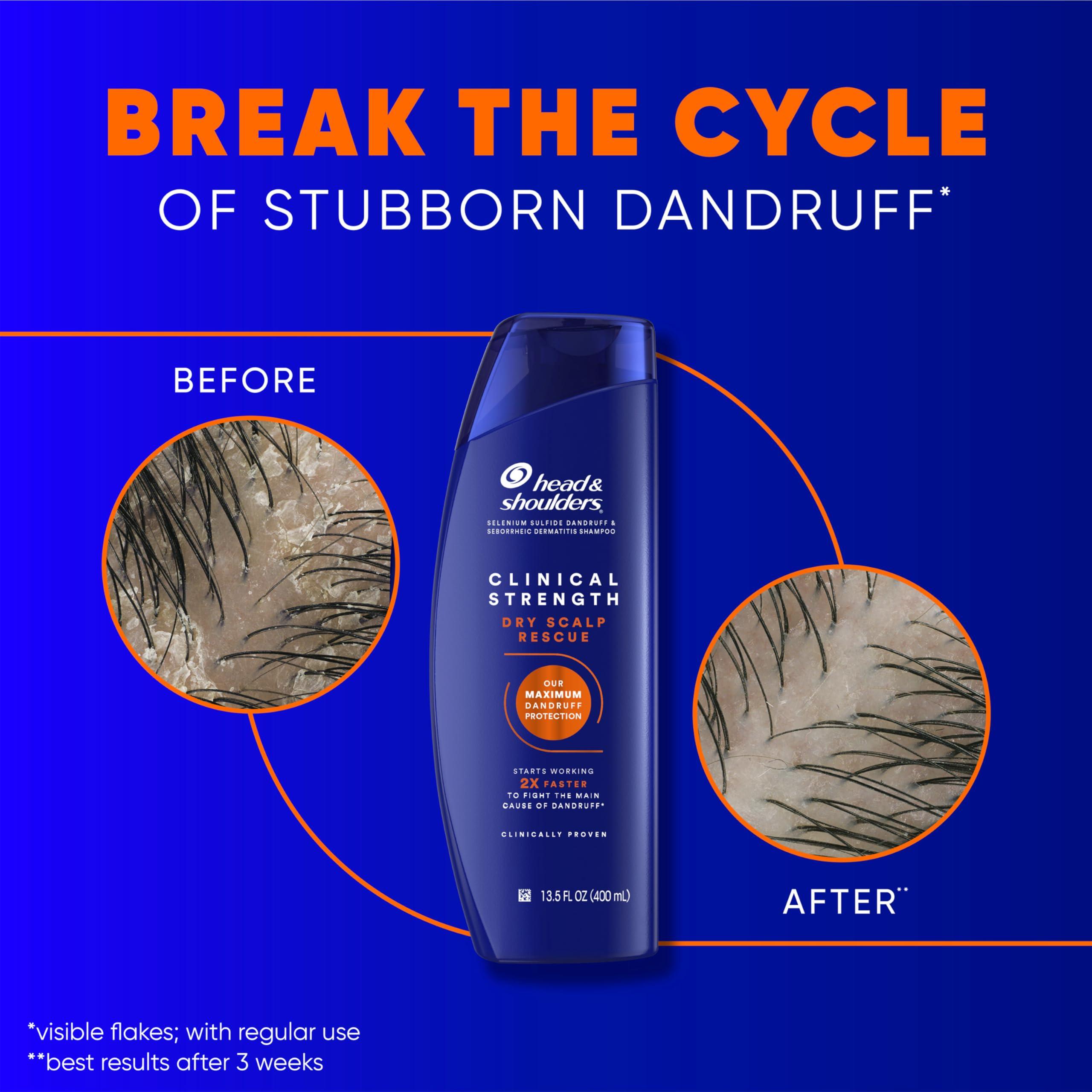 Head & Shoulders Head & Shoulders Clinical Dandruff Defense + Dry Scalp Rescue Shampoo 13.5 oz Twin Pack