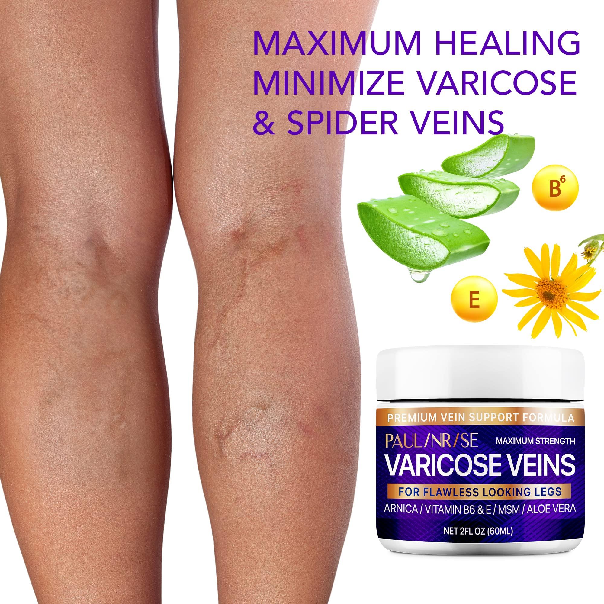 PAULINRISE PAULINRISE Varicose Vein Cream for Legs - Improves Blood Circulation, Reduces Spider Veins and Heaviness, 2 Oz