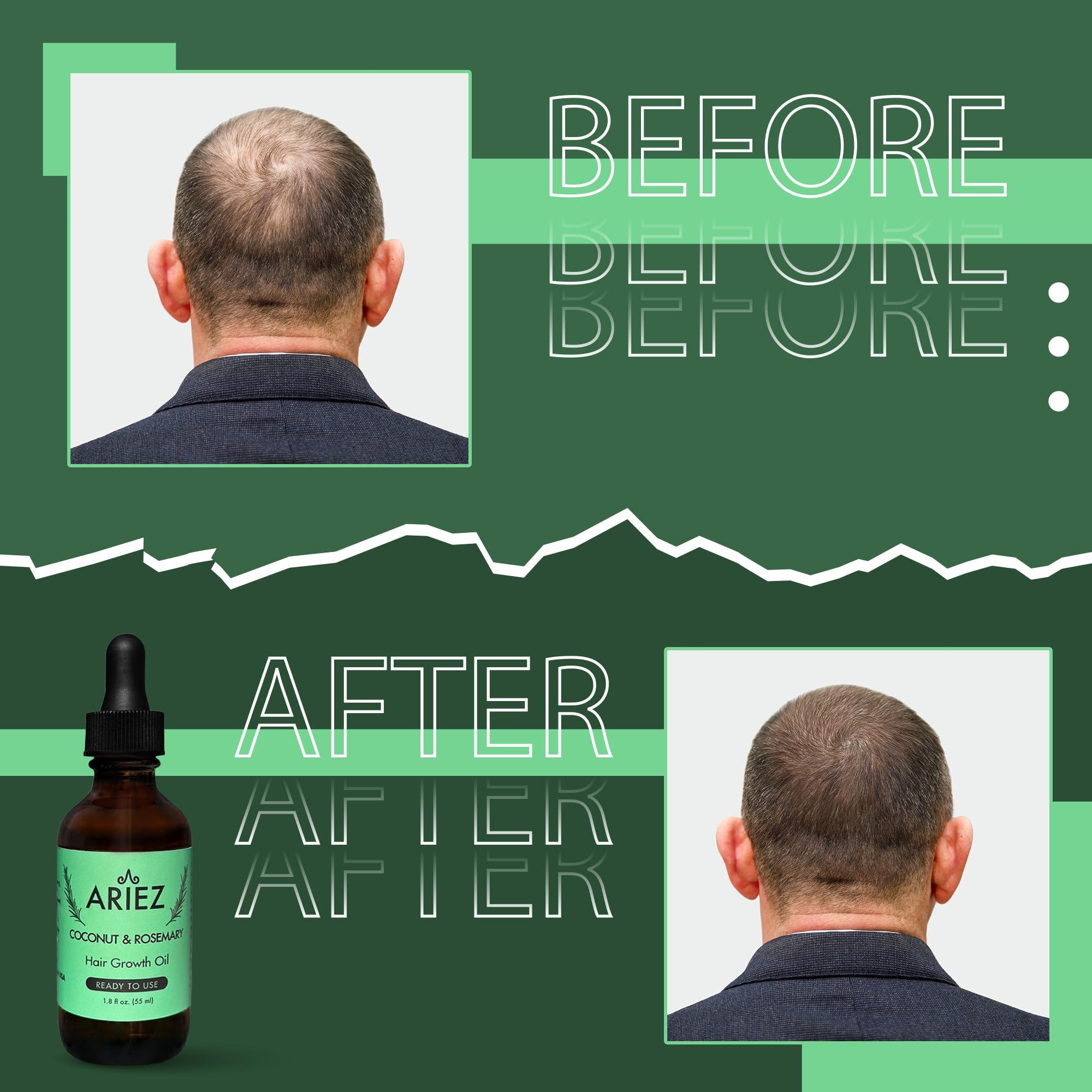 Ariez Ariez Coconut & Rosemary Oil Hair Growth Serum - Promotes Thicker and Fuller Looking Hair - For Dry & Damaged Hair - Anti Frizz- Stimulate Follicles, Promote Regrowth - Cruelty Free - 55ml