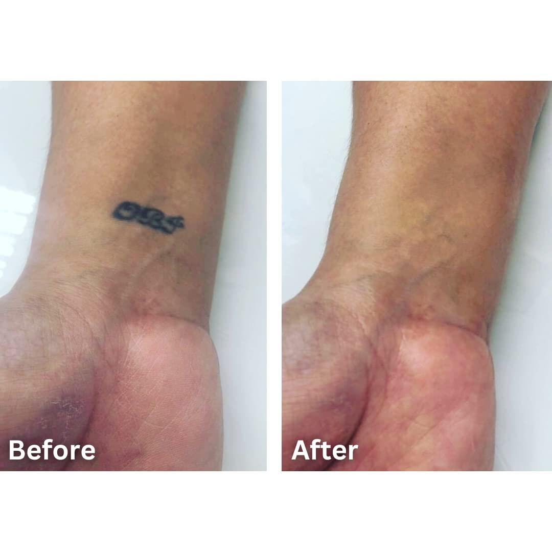 Dermaflage Dermaflage Tattoo Cover Up Makeup (Tan) - Bruise Full Coverage Concealer - Full Coverage Waterproof Concealer for Bruise, Scars & Acne - Smudge Proof Body Makeup Palette with 3 Pro SFX Shades + Brush