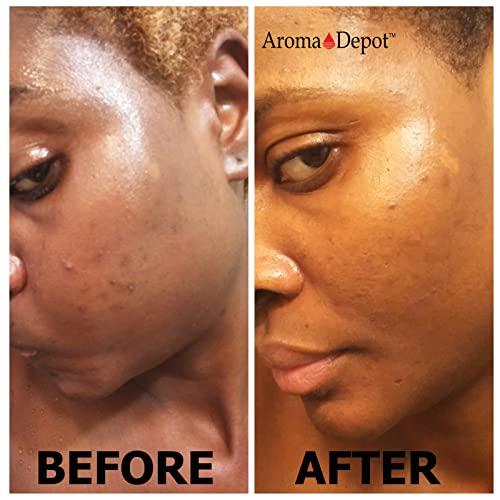 Aroma Depot Aroma Depot Raw African Black Soap Bars From Ghana (3 lbs.)