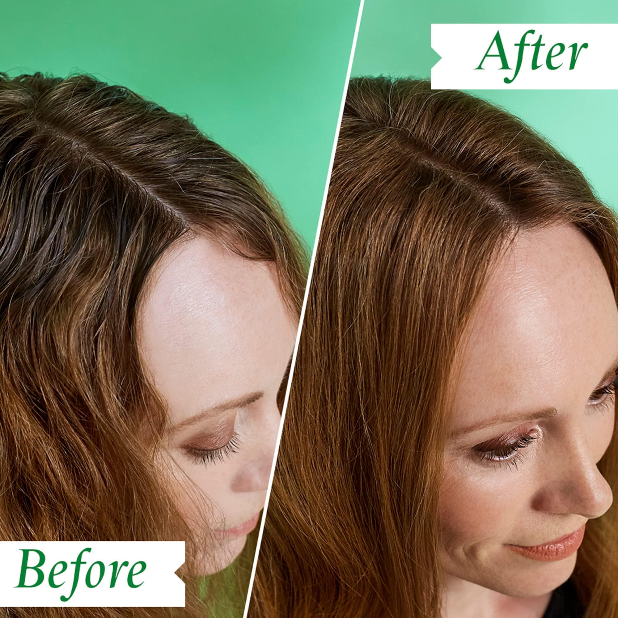 PHILIP KINGSLEY Philip Kingsley Flaky Scalp Shampoo, 8.45 Ounce