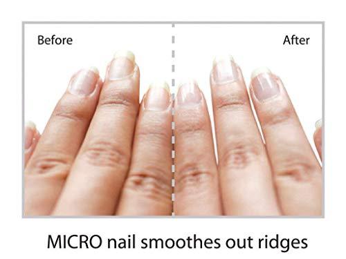 Emjoi Emjoi Micro Nail Manicure or Mani Pedi--Smooths, Buffs & Shines Instantly