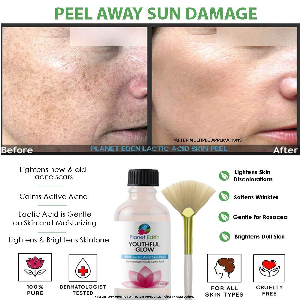 Planet Eden Planet Eden 88% Lactic Acid Skin Chemical Peel Kit with Antioxidant Recovery Cream and Fan Brush - Alpha Hydroxy Acid - Reduce the Signs of Aging with a At Home Skin Peel