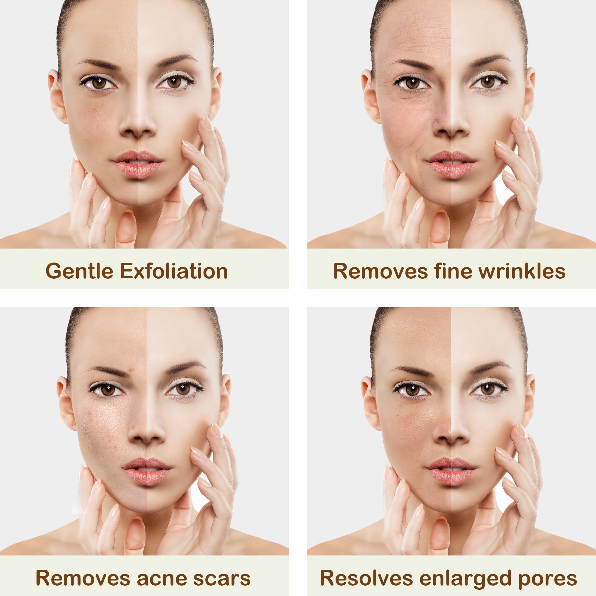 Kendal Kendal 3 in 1 Professional Diamond Microdermabrasion Machine