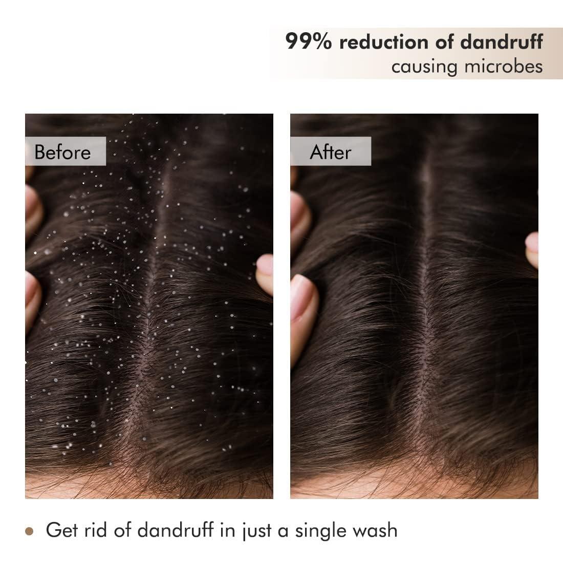 India Anti Dandruff Coffee Scalp Scrub - 99% Dandruff Control Treatment for Men & Women | Scalp Exfoliator & Dandruff Remover | For Itchy Scalp in Hot & Humid Weather- 250gm, White