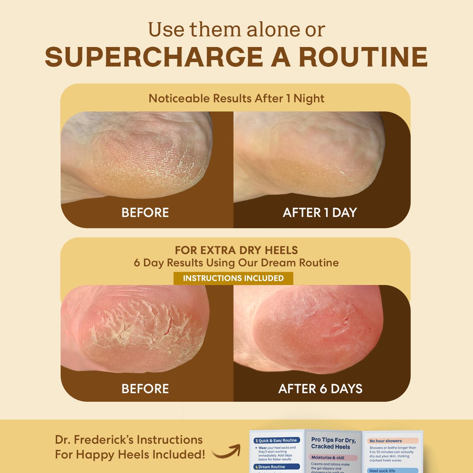 Dr. Frederick\'s Original Dr. Frederick\'s Original Moisturizing Fuzzy Heel Socks - 2 Pairs - Cozy Gel-Lined Sleep Socks for Women & Men - Soothing Dry, Cracked Feet - Cracked Heel Repair - Heal Dry Heels - Citrus Glow