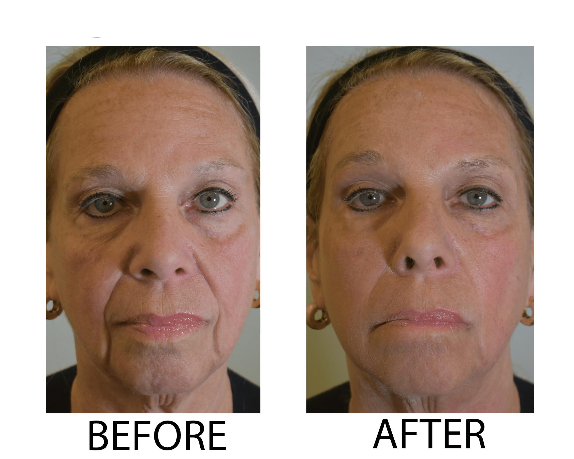 Dr.Sevinor Skincare Solutions Dr Sevinor Wrinkle Solution Wrinkle Smoothing Tinted Serum 1 FL OZ