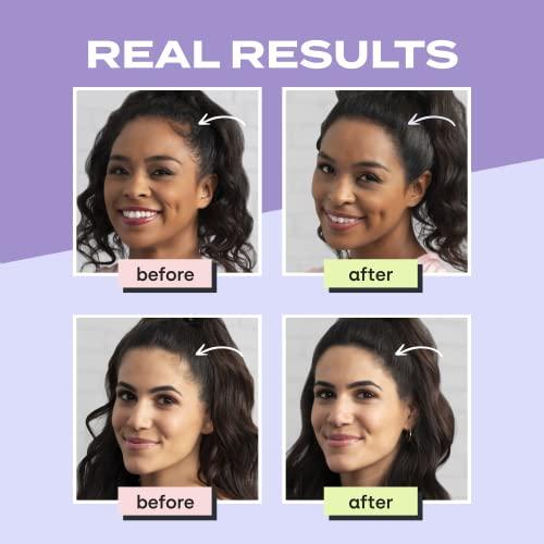 Toppik Hair Filler Toppik Hair Filler Keratin Hair Fiber Powder 12g - Hair Thickener for Women, Camoflauge Roots, Fills Hairline Gaps For Fuller Hair - Dark Brown