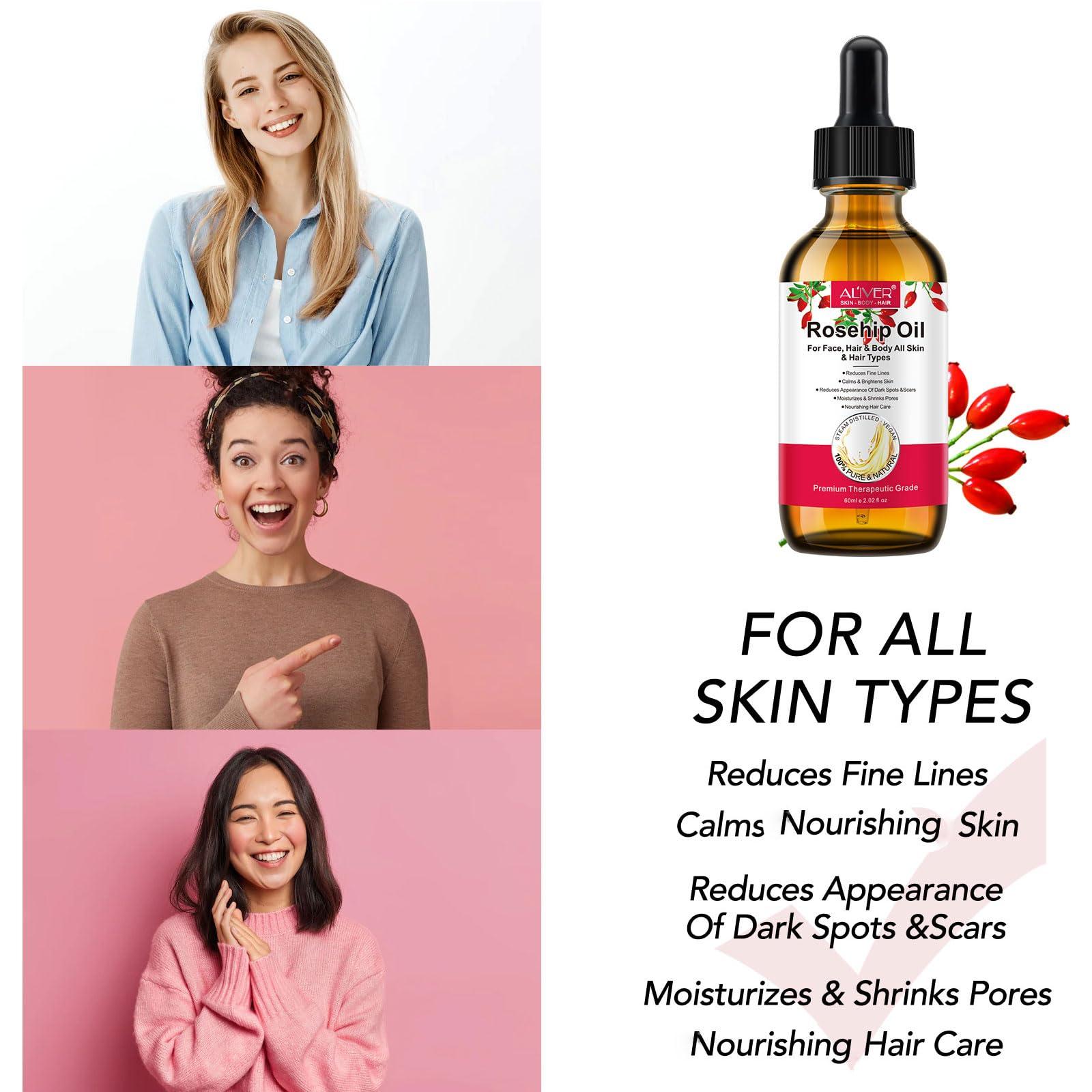 Onznoz Rosehip Oil for Face, Rose Hip Oil Organic Rosehip Seed Oil 100% Pure Cold Pressed for Anti-Aging, Nourishing Hair Care, Face & Skin (2.02 Fl Oz)