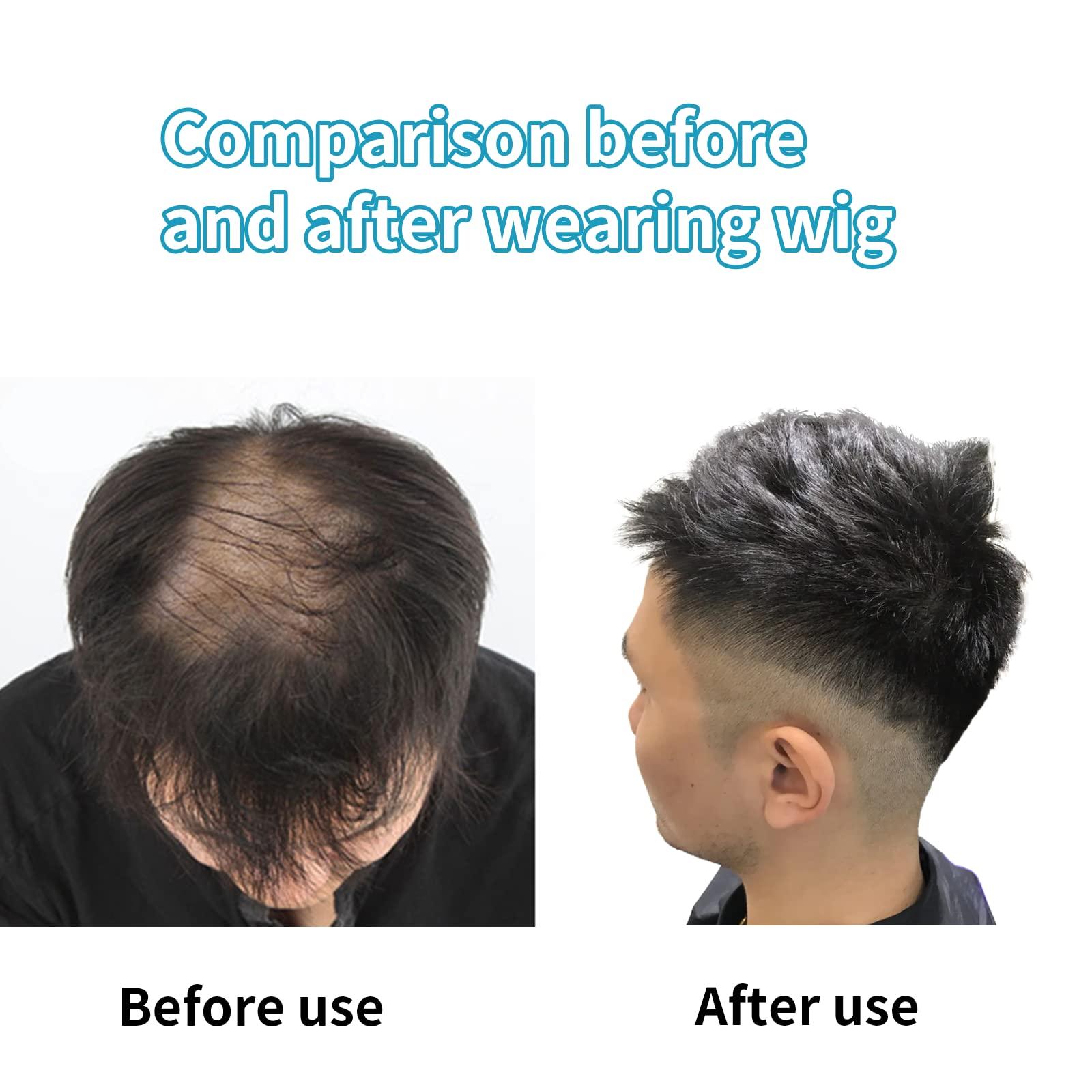 WeKen WeKen Short Toupee for Men Hair Topper Wig Clip in Crown Hair Extensions Mens Hair Piece for Covering White Loss Hair Daily Wear
