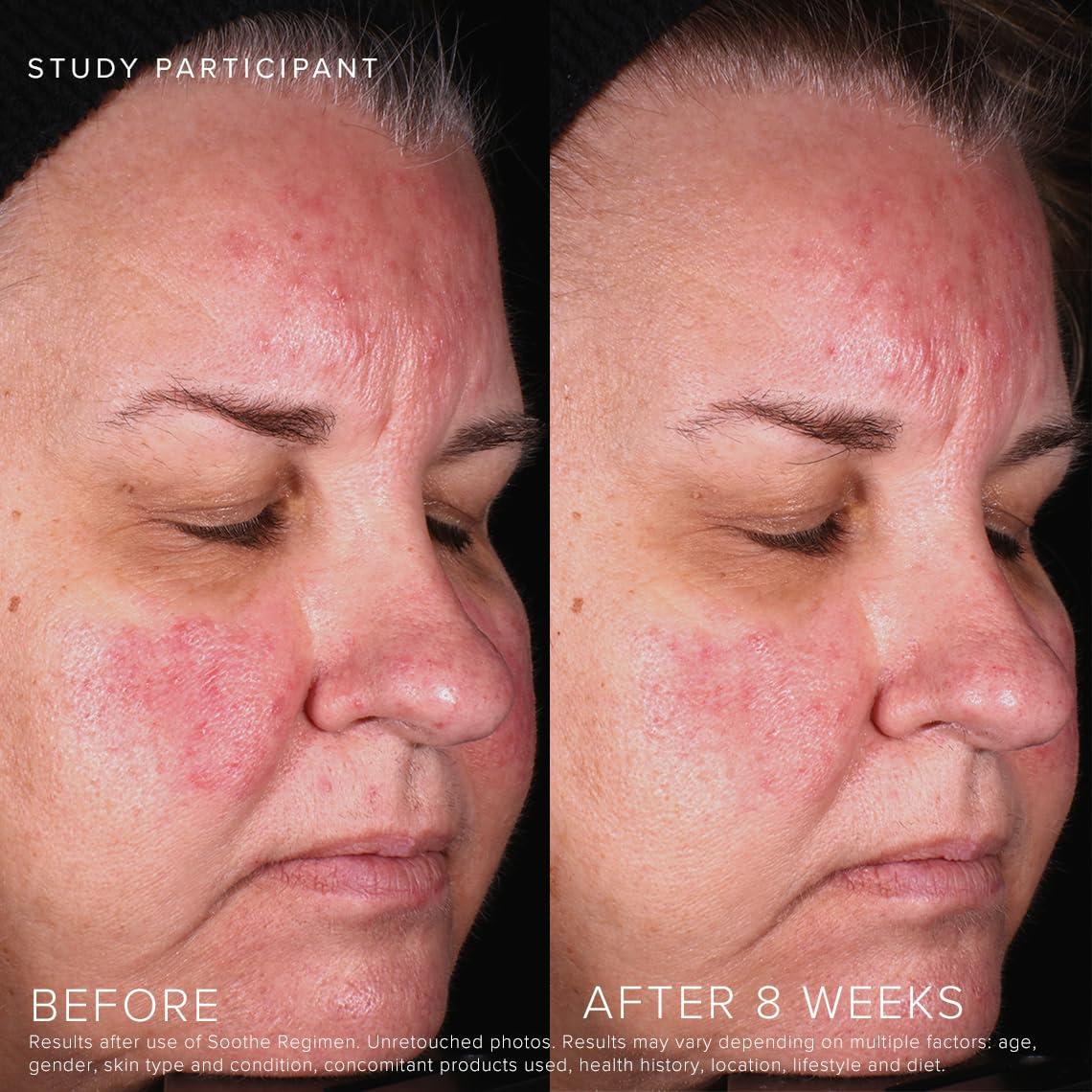 RODAN + FIELDS Rodan + Fields Soothe Calming Gel Cleanser 125 ml | Gentle Cleanser for Dry & Sensitive Skin | Daily Face Cleanser for Women and Men, Moisturizing & Hydrating Skincare