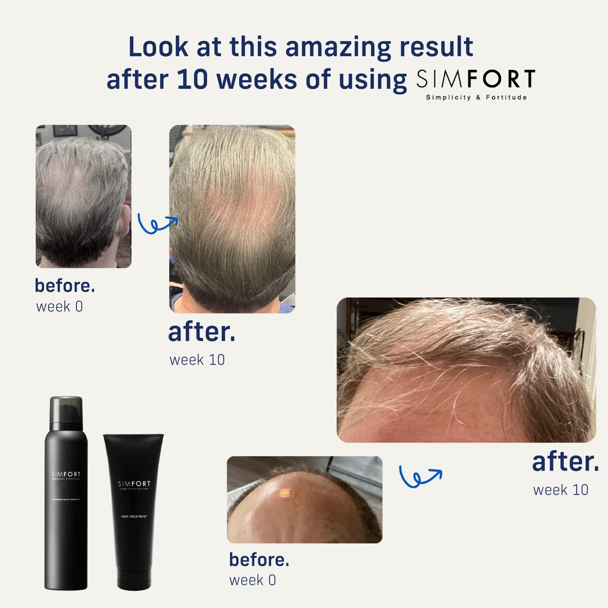 SIMFORT SIMFORT Carbonic Acid Shampoo 5.3oz & Conditioner 4.2oz Set for Men & Women, Fuller Thicker Stronger Hair Growth and Volumizing, Made with Natural Ingredients, NO Paraben/Sodium/Sulfate (Set of 1)